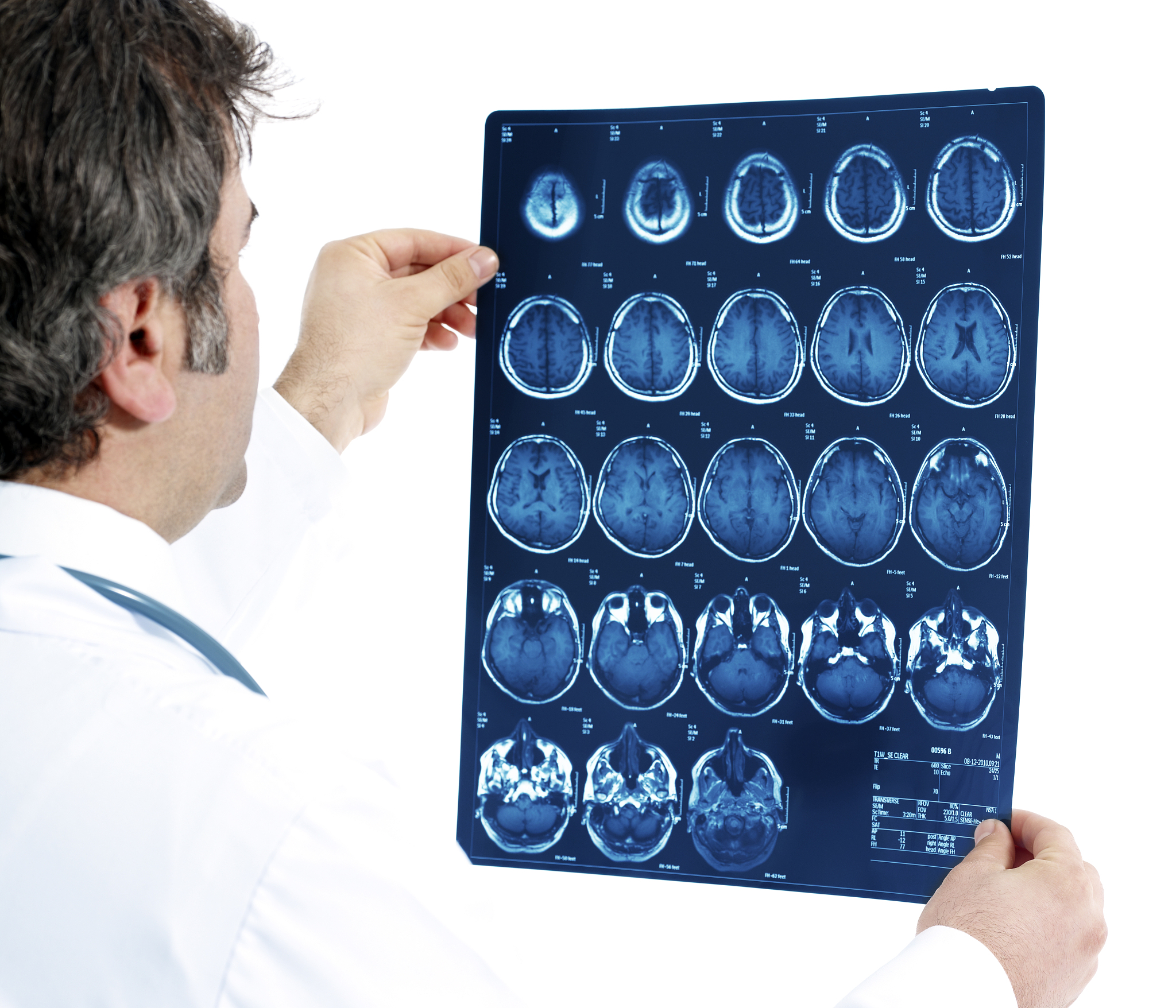 深度学习在diabetic retinopathy领域的研究现状