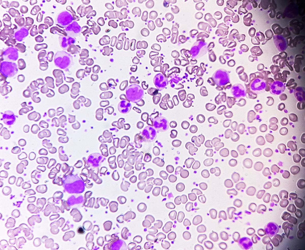 菌菇中毒类型及症状 - 详细介绍