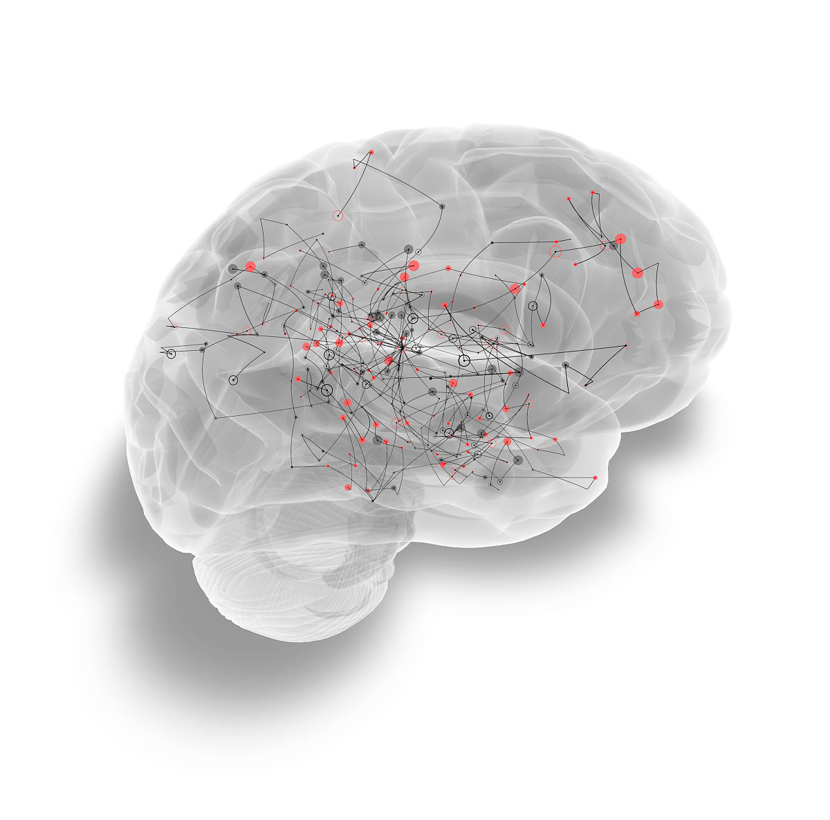 脑地形图 vs. 脑电地形图：区别解析