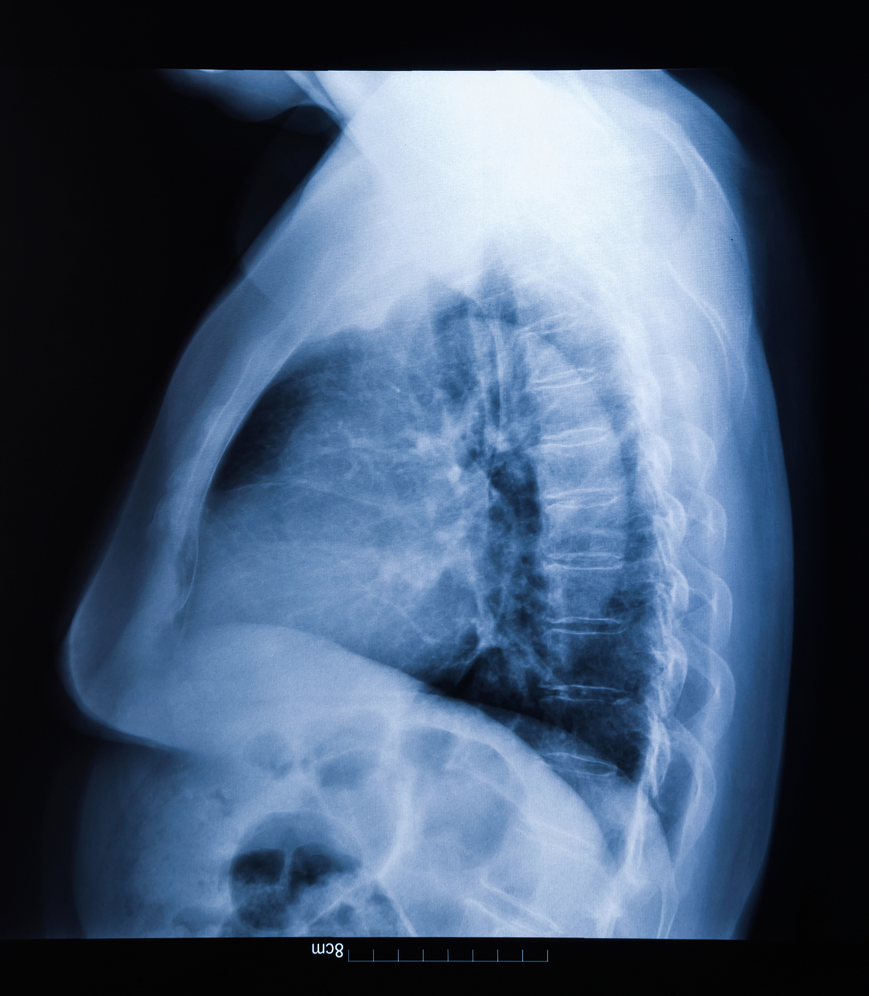 不小心吃下电池会咋样