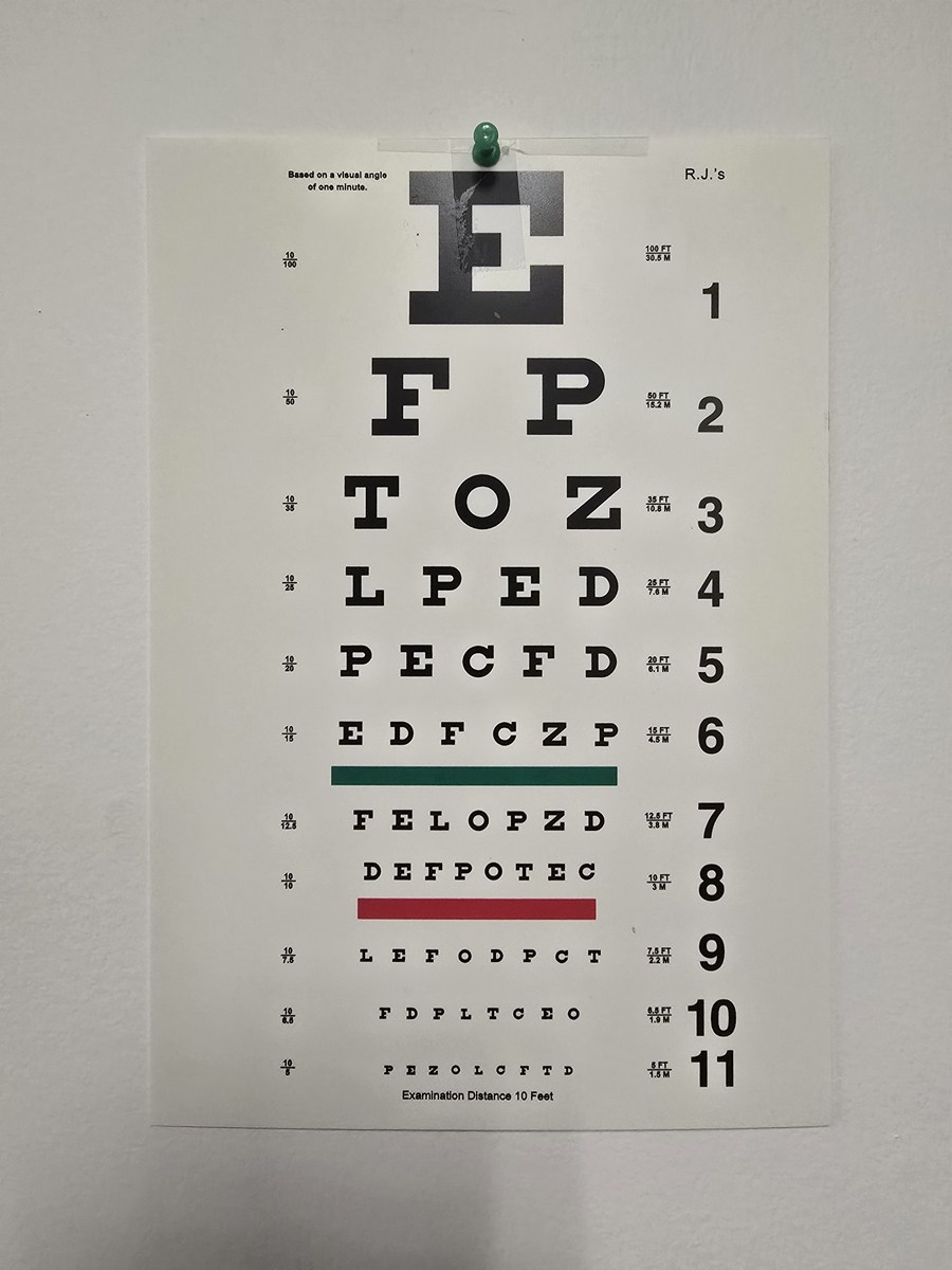 400 度近视，视力是 4.9 吗？