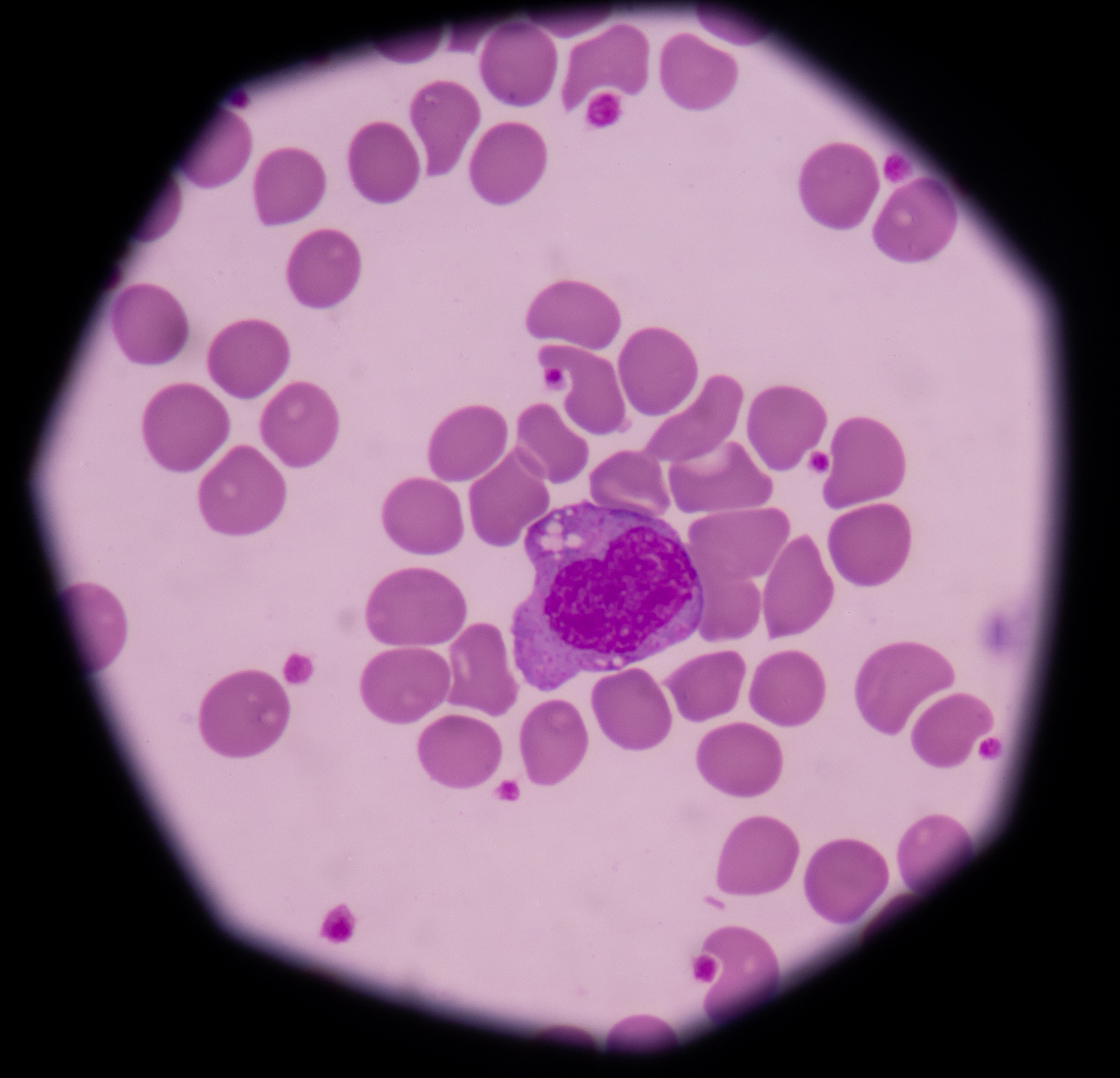 白细胞分类及正常比例范围