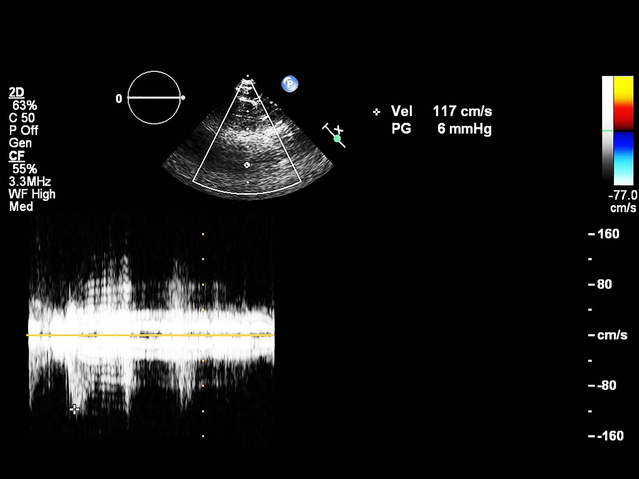 对于超声而言频率越高穿透深度越深吗？