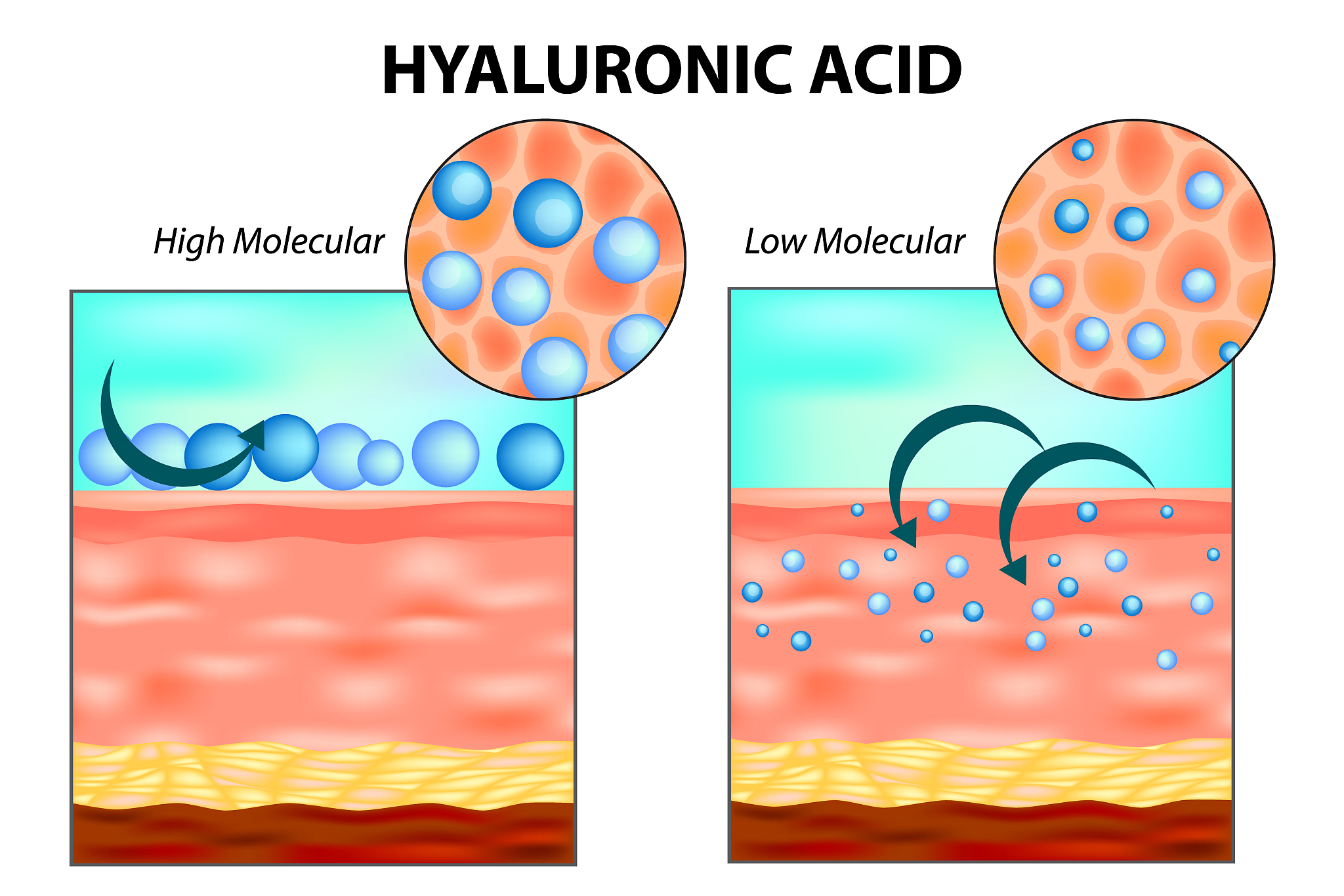 Bio-inspired antioxidant heparin-mimetic peptide hydrogel for radiation-induced skin injury repair本文亮点在哪里 中文回答