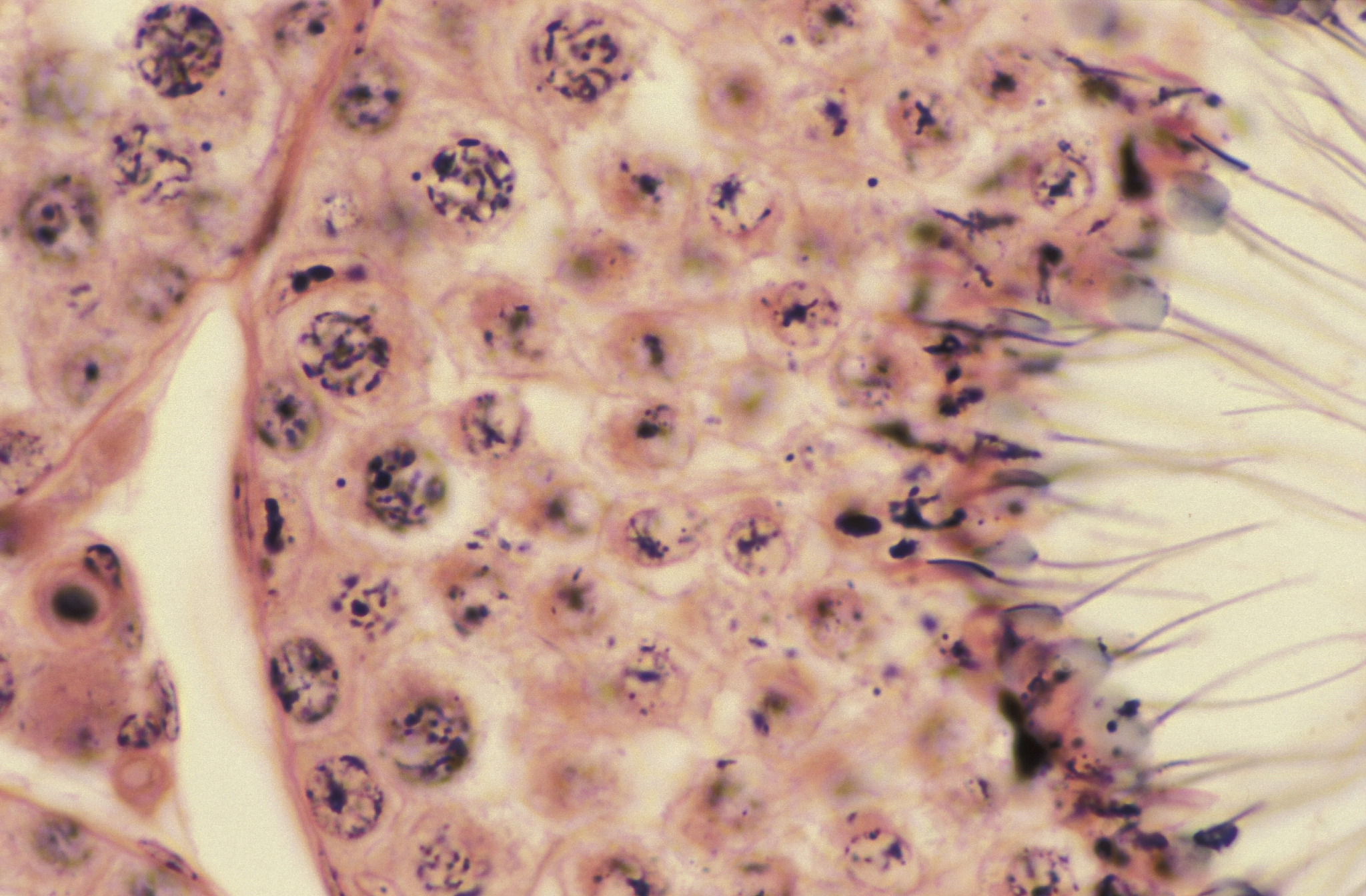 男性精子是如何产生的？ - 睾丸功能和精子生成过程