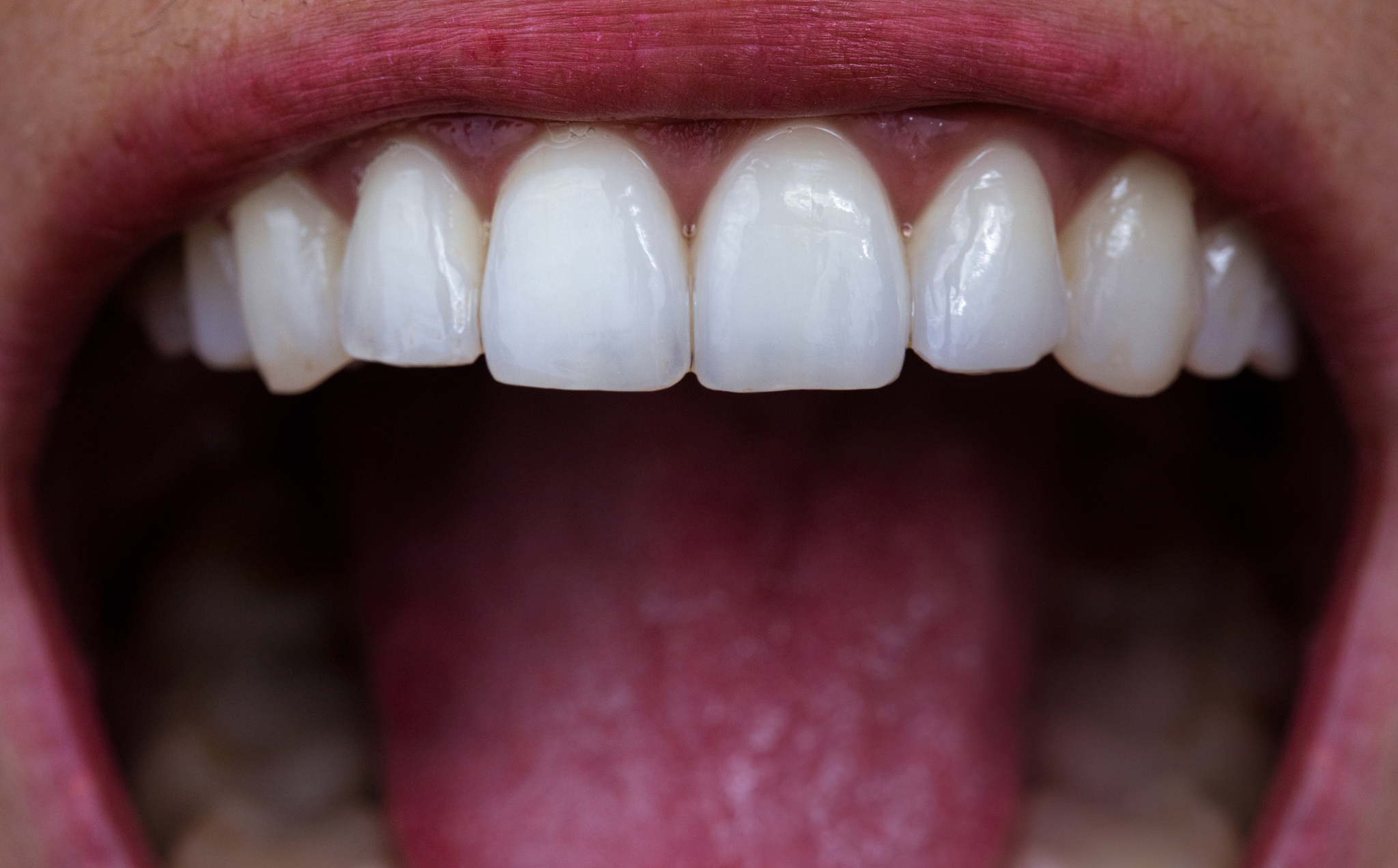 云南省大理卫生学校护理口腔护理方向专业招生