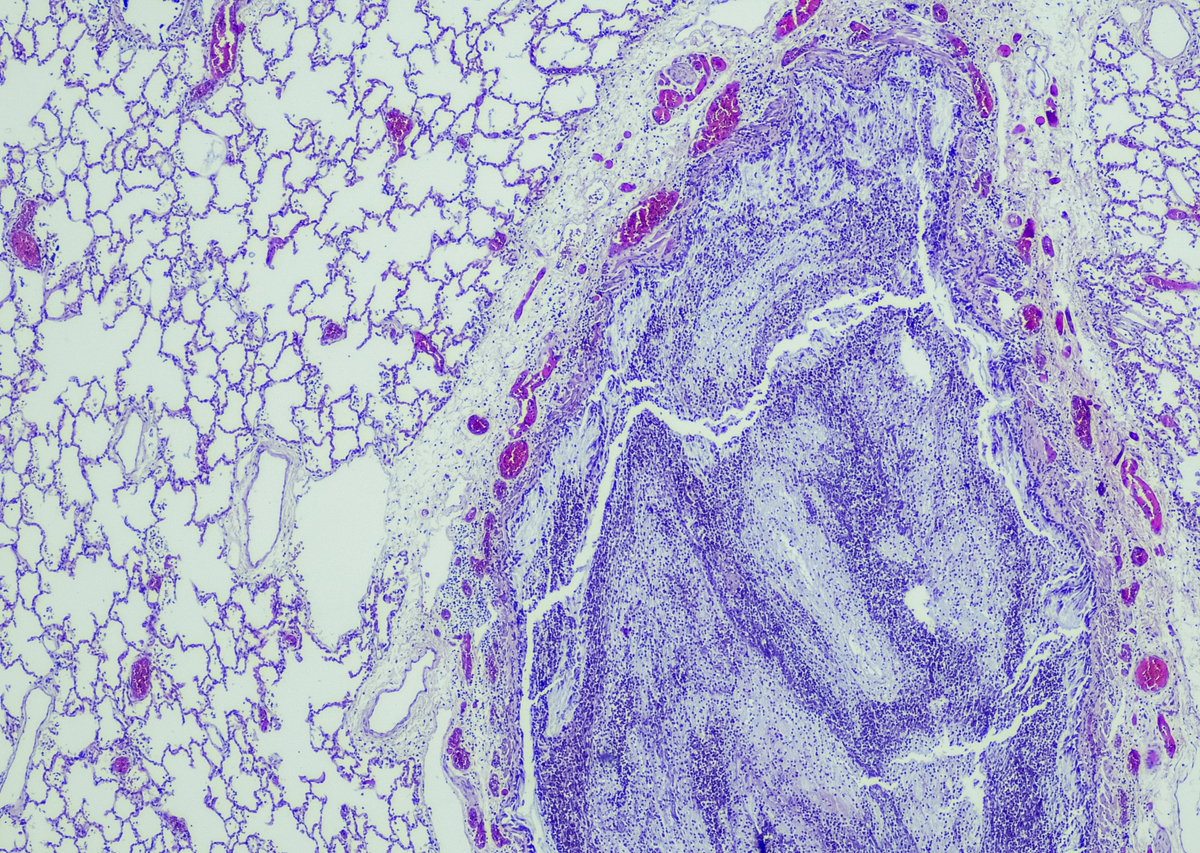 用更为地道、科学的中文表达如下内容：HUVEC displayed self-organization forming a complex multilayered network of interconnected micro-vessels while maintaining their 3D lumenized stability