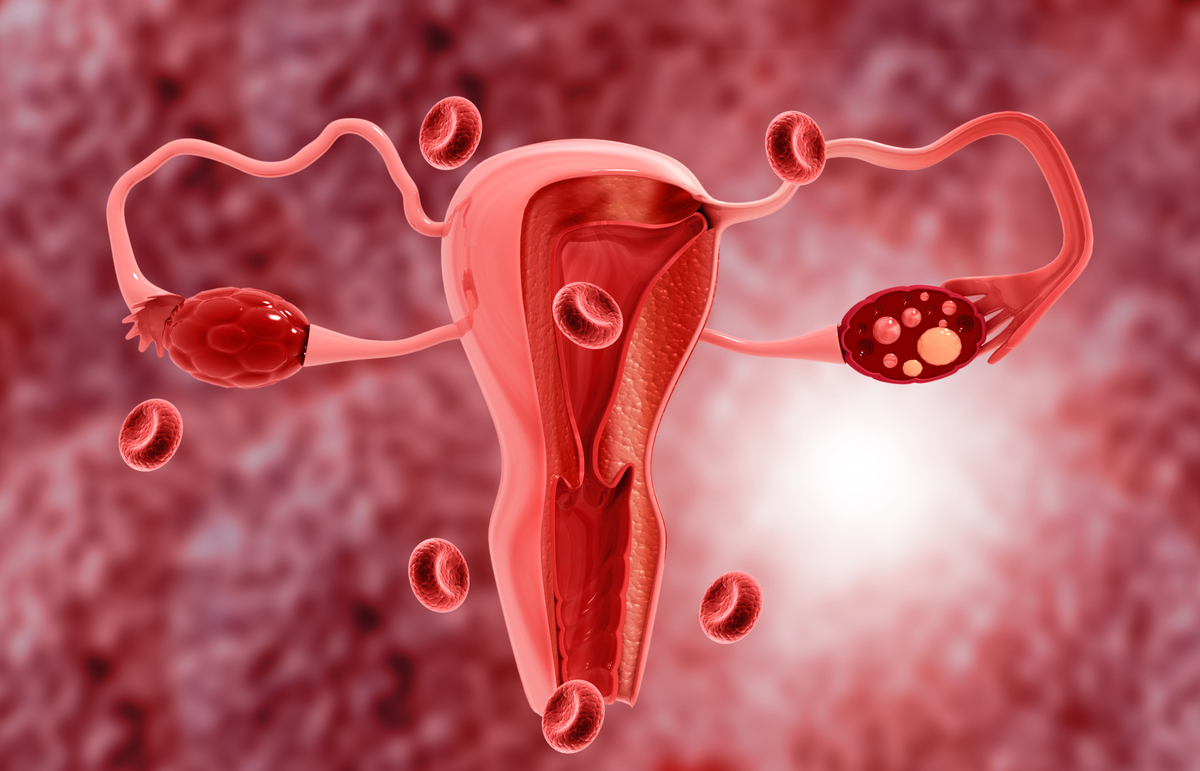 女性绝育之后内射之后精子会变成什么