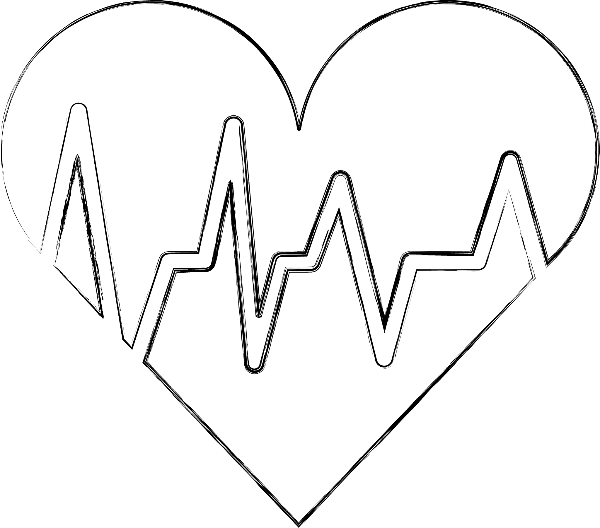 心电图解读：肢体导联P波时间和位置