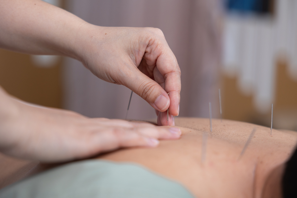 2019年重庆职校针灸推拿专业介绍