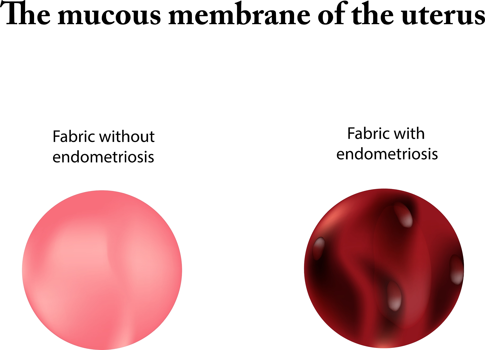 卵泡发育过程与子宫内膜的发育的关系