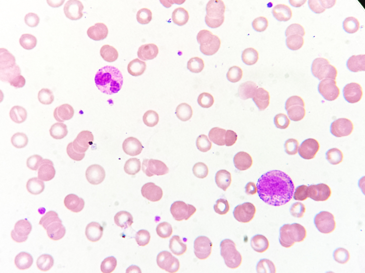 人体细胞平均重量是多少？不同类型细胞重量差异大