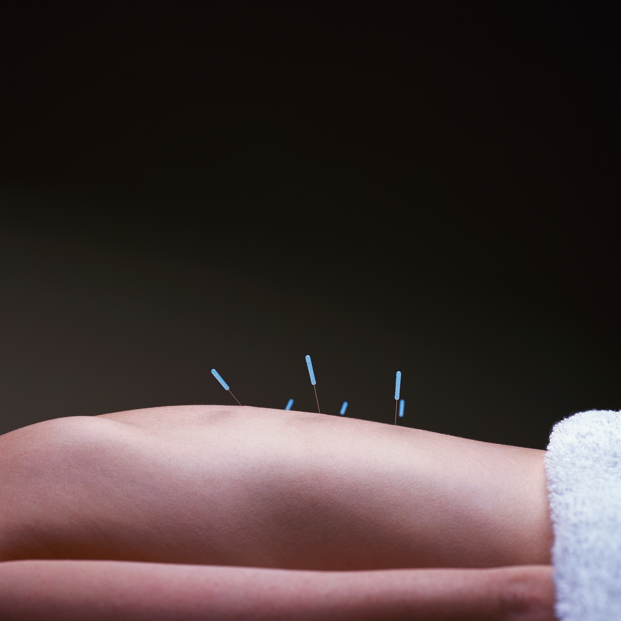 腋毛去除方法：哪种方式最适合你？