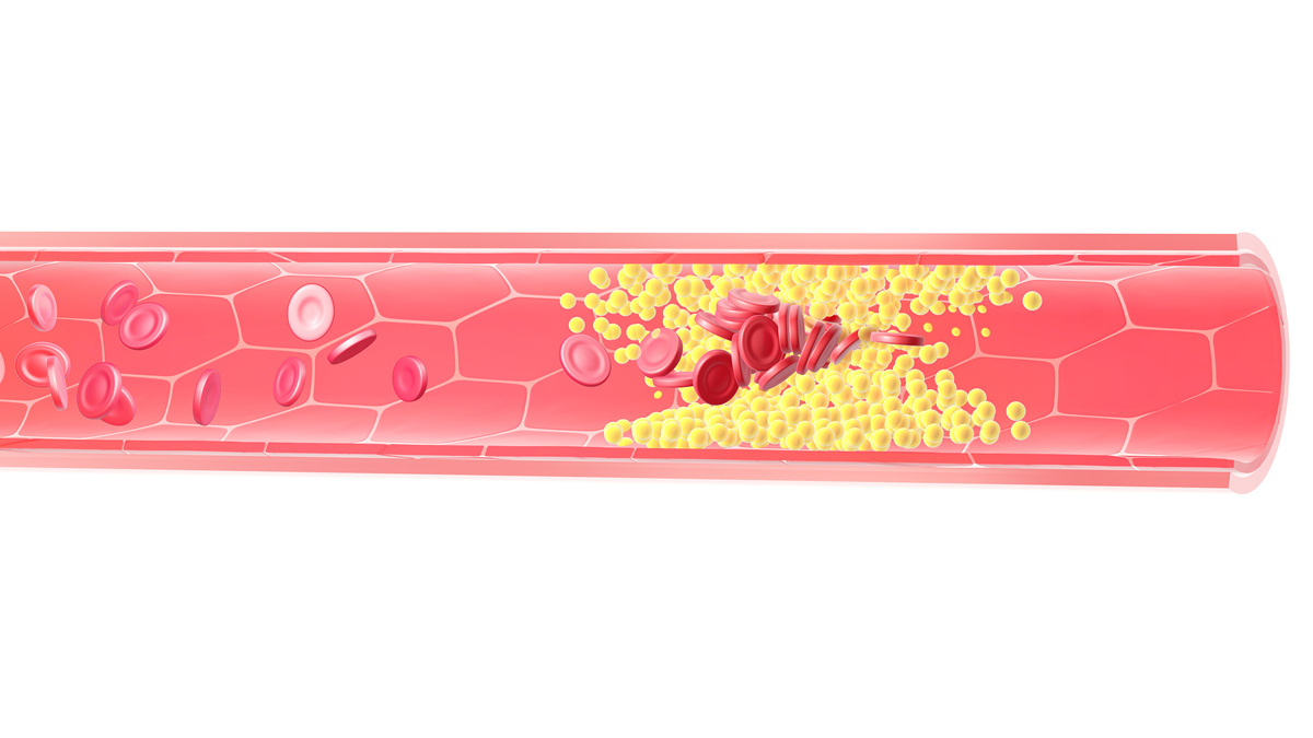 血管内皮细胞：功能与心血管疾病的关系