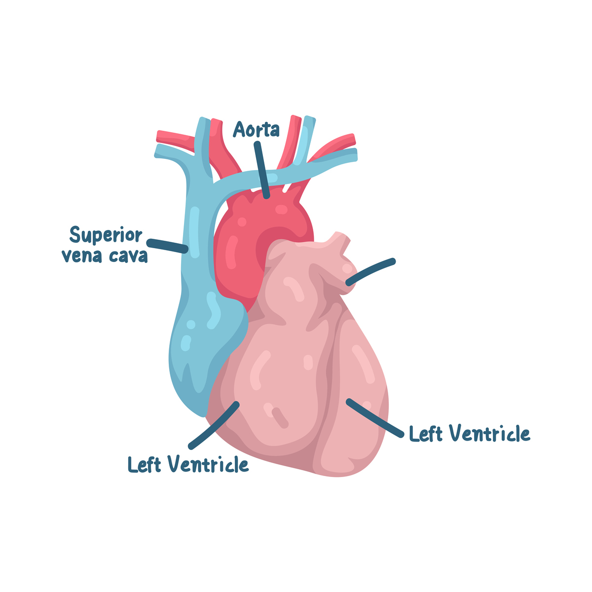 心衰伴心包积液：症状、并发症及治疗方法