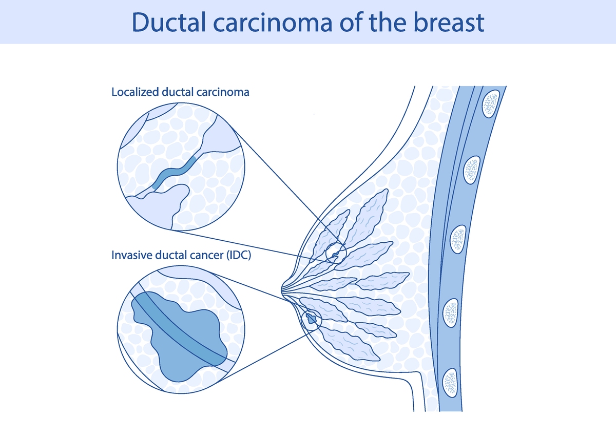 Breast Expansion in Science Fiction: Exploring the Trope and its Reality