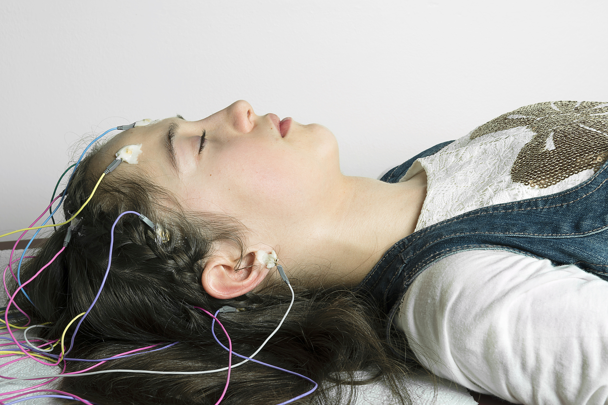 如何进行10-20标准导联电极安放应该至少先定位哪四个点回答尽量详细