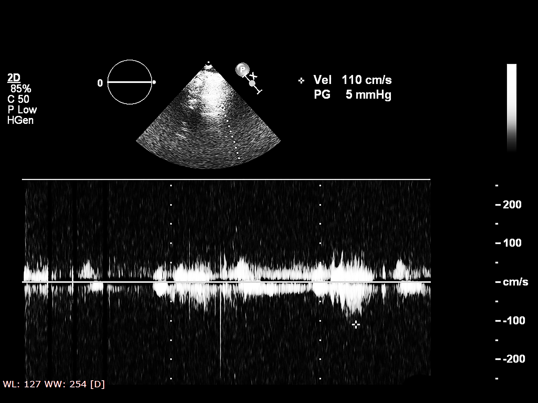 类星体宽吸收线速度漂移的时变性研究：证据与解释
