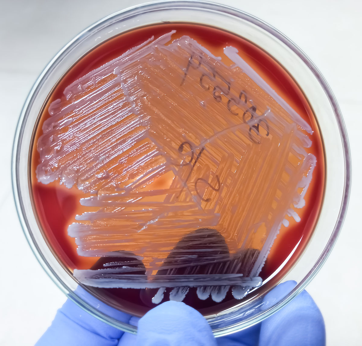 含有百分之2的琼脂的培养基硬度怎么样