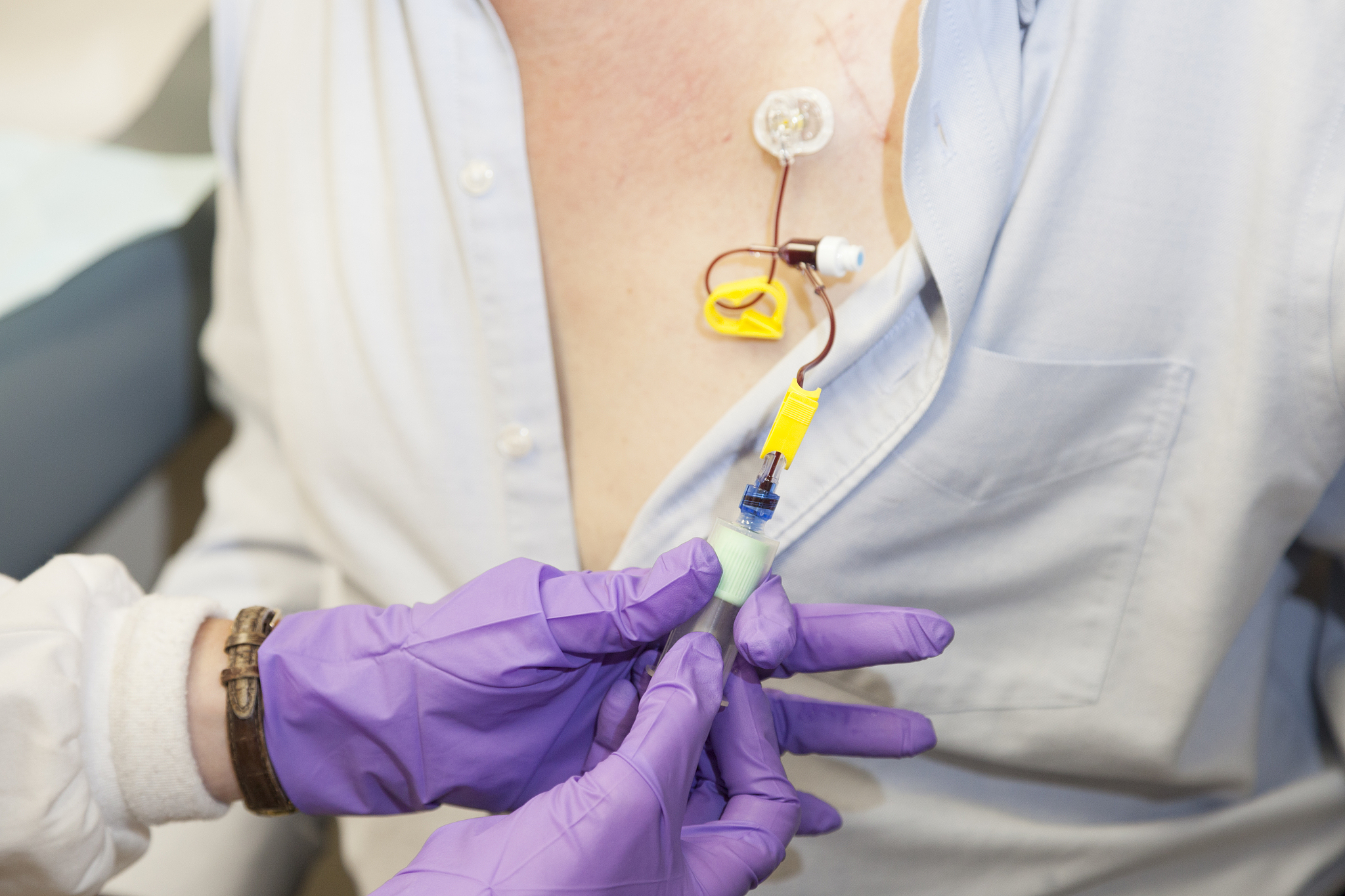 男性乳房发育原因