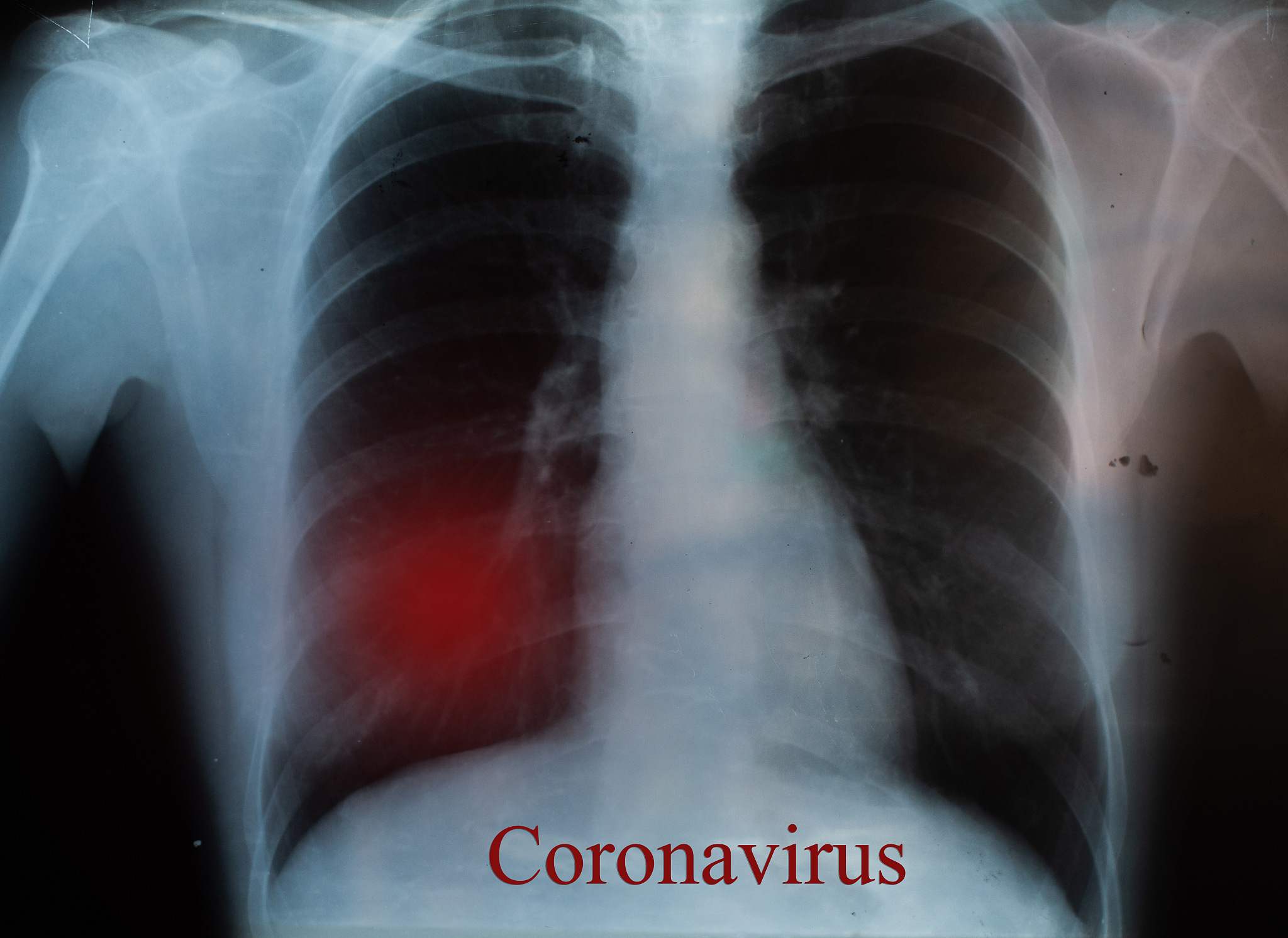 x-ray of the lungs with inflammation with the inscription red te