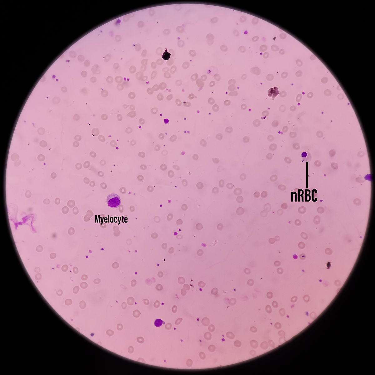 犬先天性巨血小板减少症临床表现