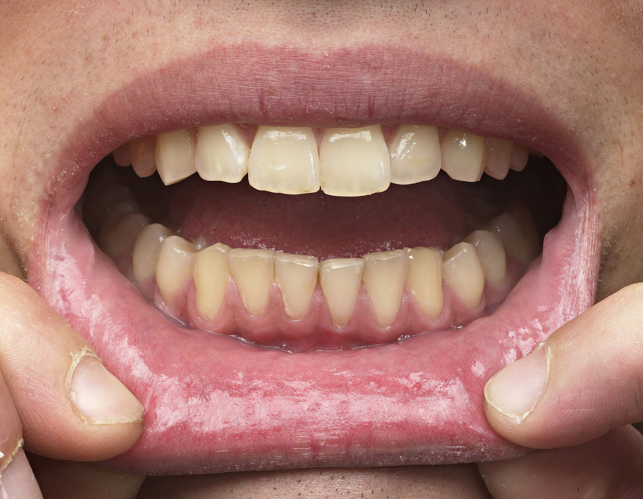 贵州医科大学口腔医学专业：就业岗位、前景及发展方向