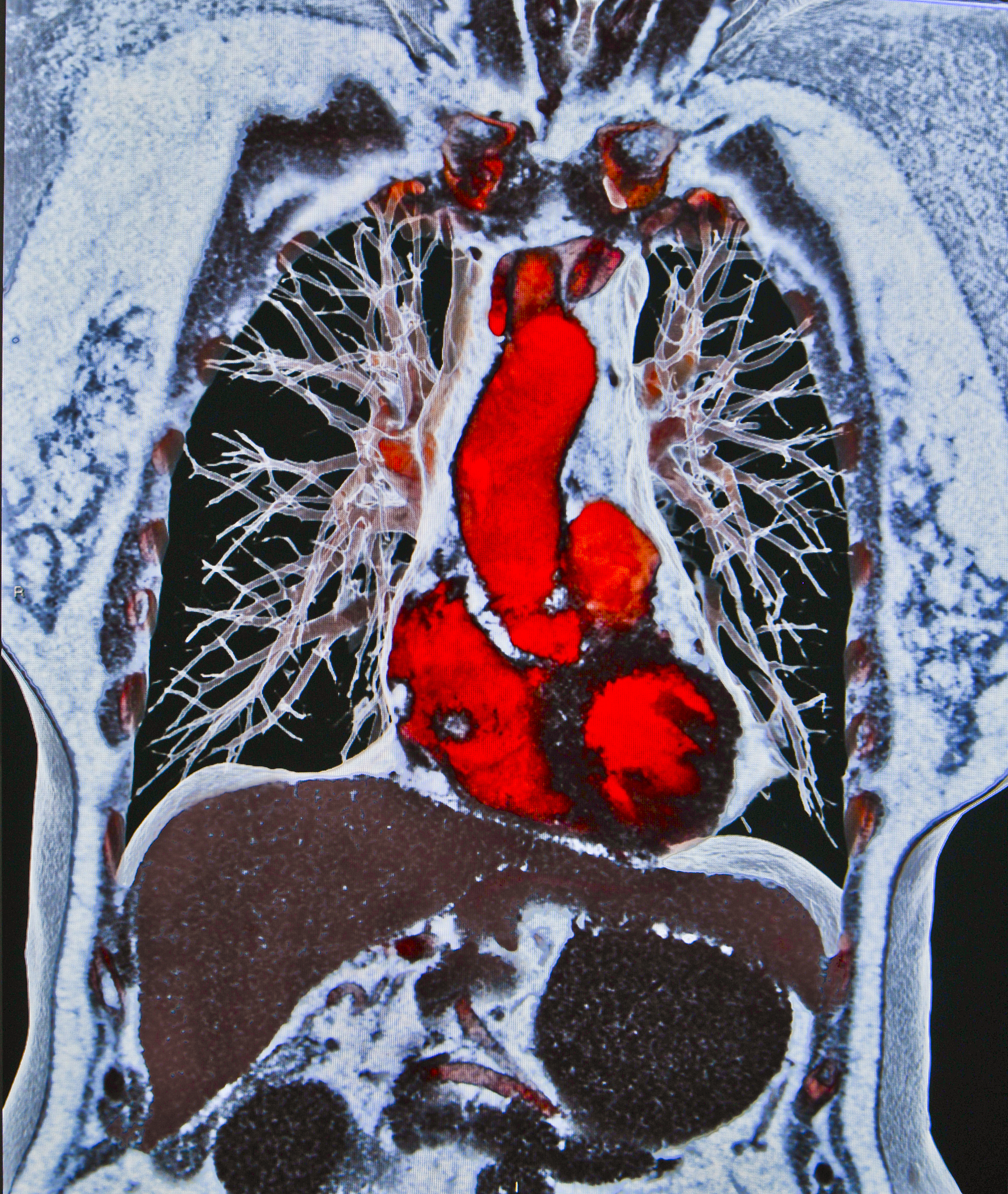 公证档案扫描多少钱一页？- 影响价格因素解析