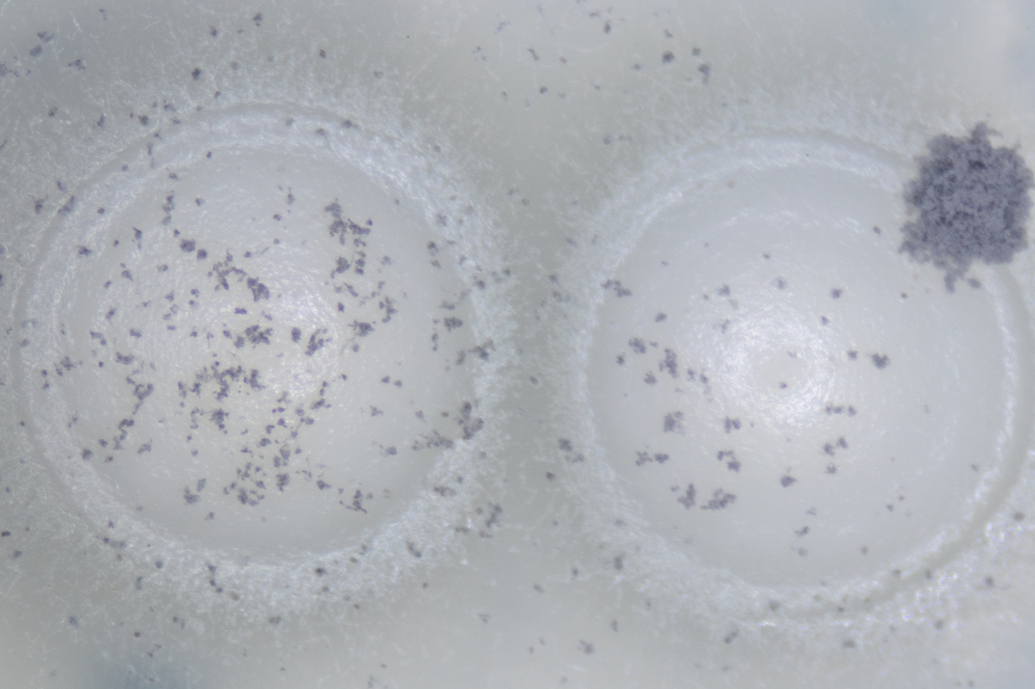 为什么有的大豆堆表面上长得霉菌是白色的而表面以下往往是灰色的