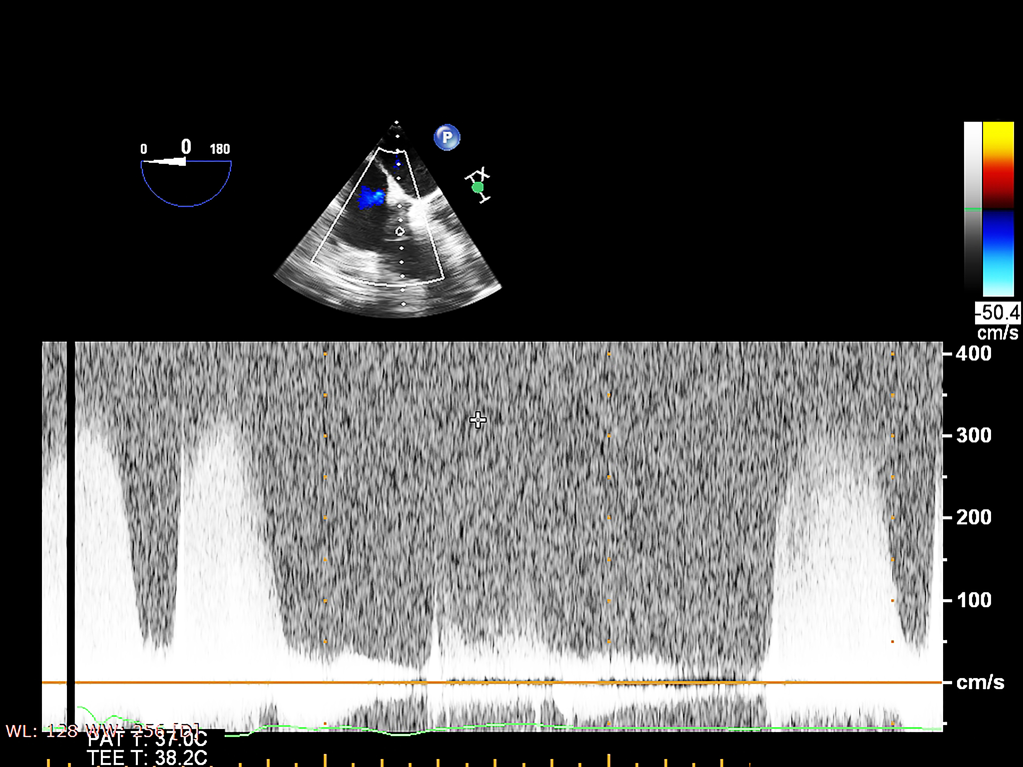 我们分别准备了超声导波和混凝土相控阵的断层扫面议的讲解讲给领导听