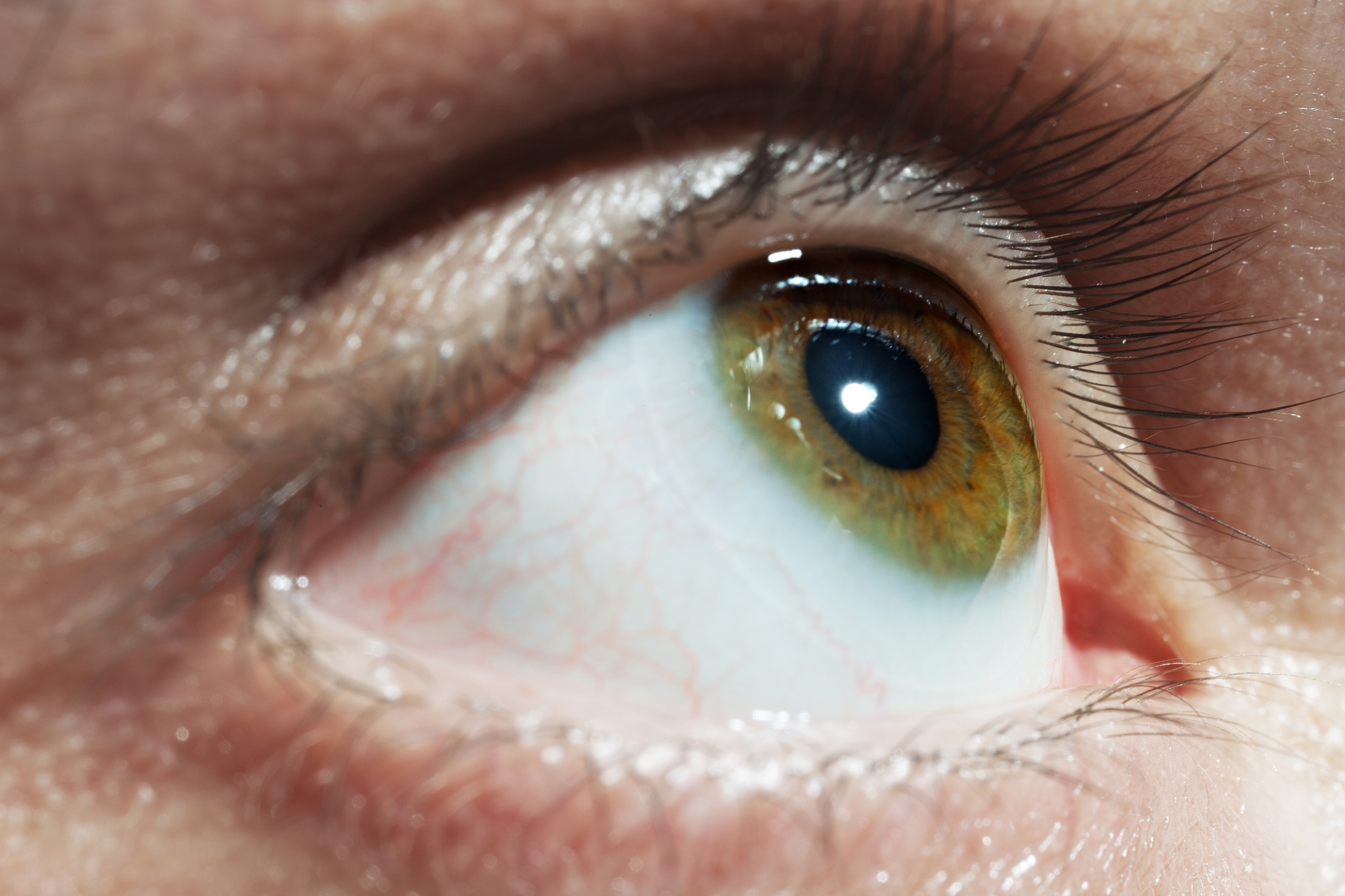 green men eye with red blood vessels close up