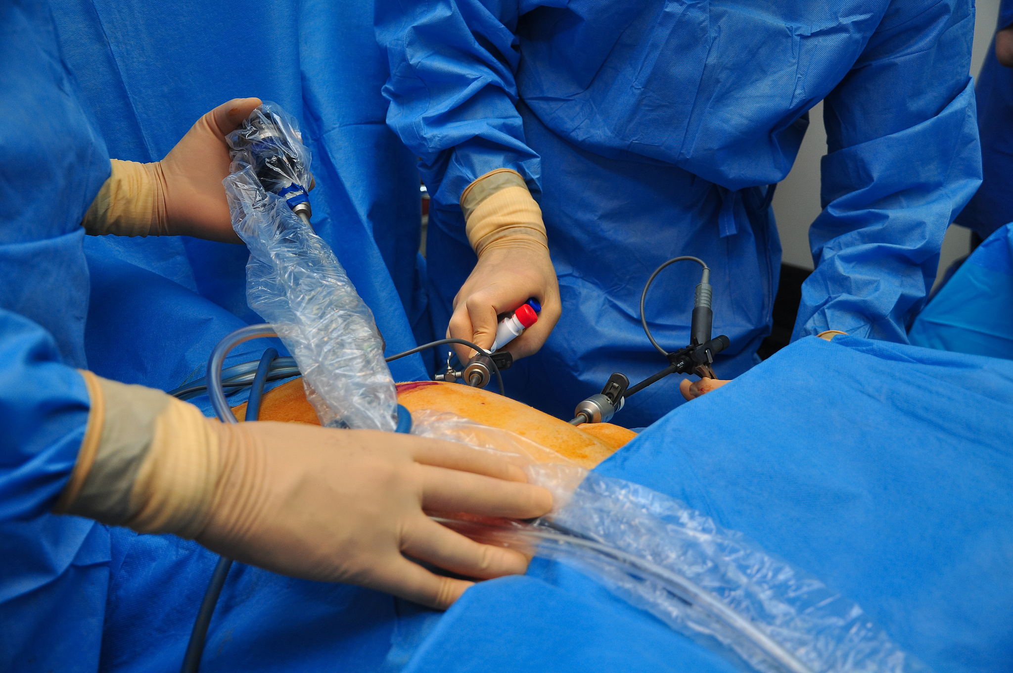 surgeons on a job