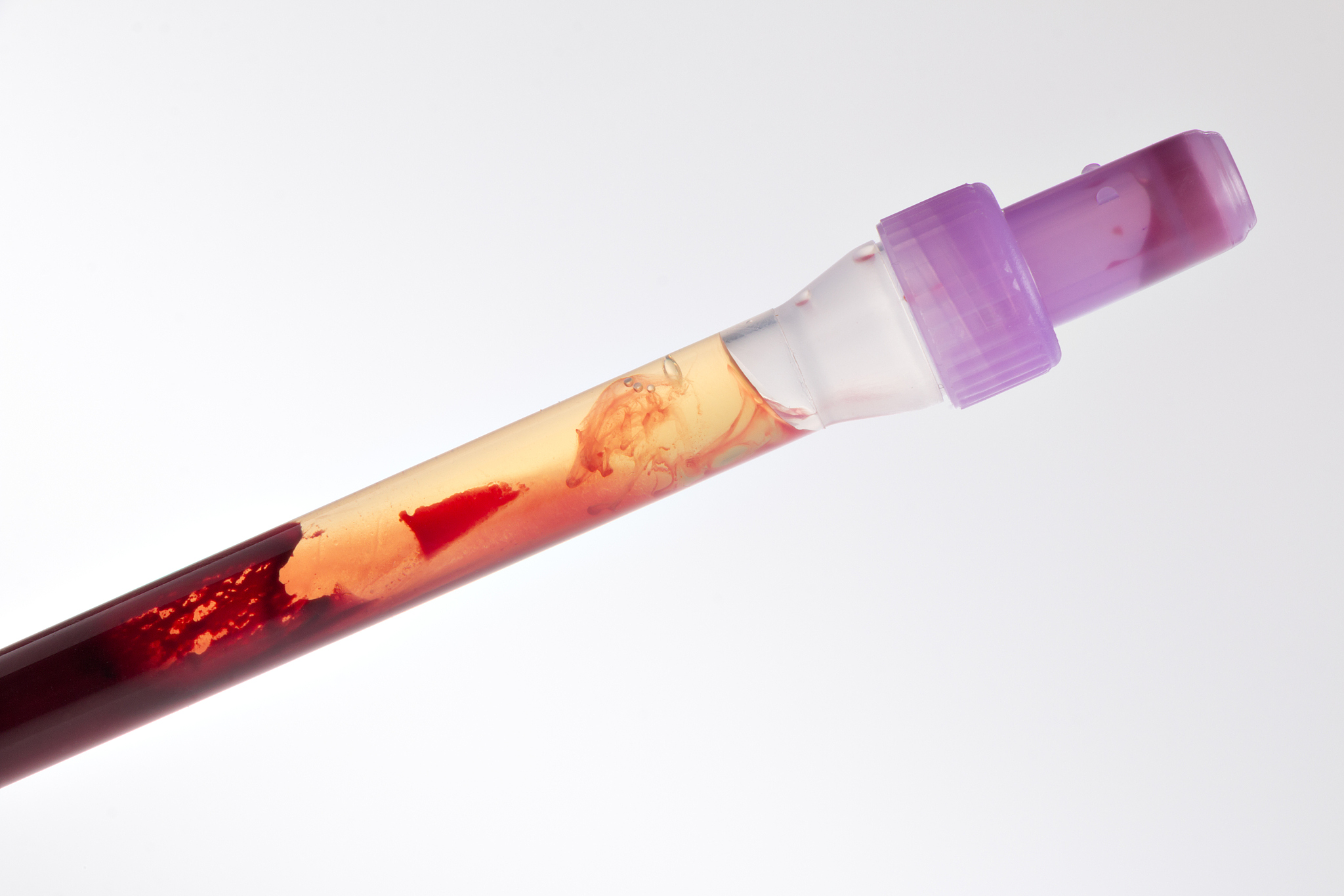 学习医学检验专业都需要考取哪些证书呢