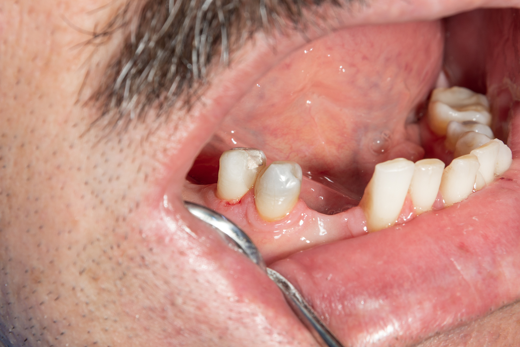 2022年长治卫生学校口腔修复工艺专业招生