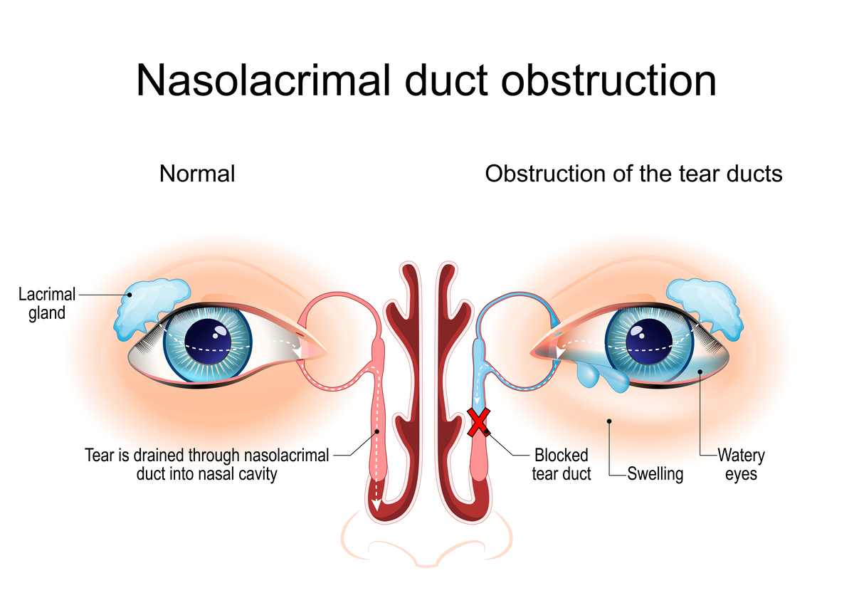 Why Do My Eyes Water After Washing Them? - ChatGPT