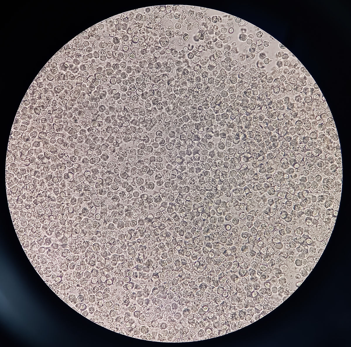 精子质量怎么查