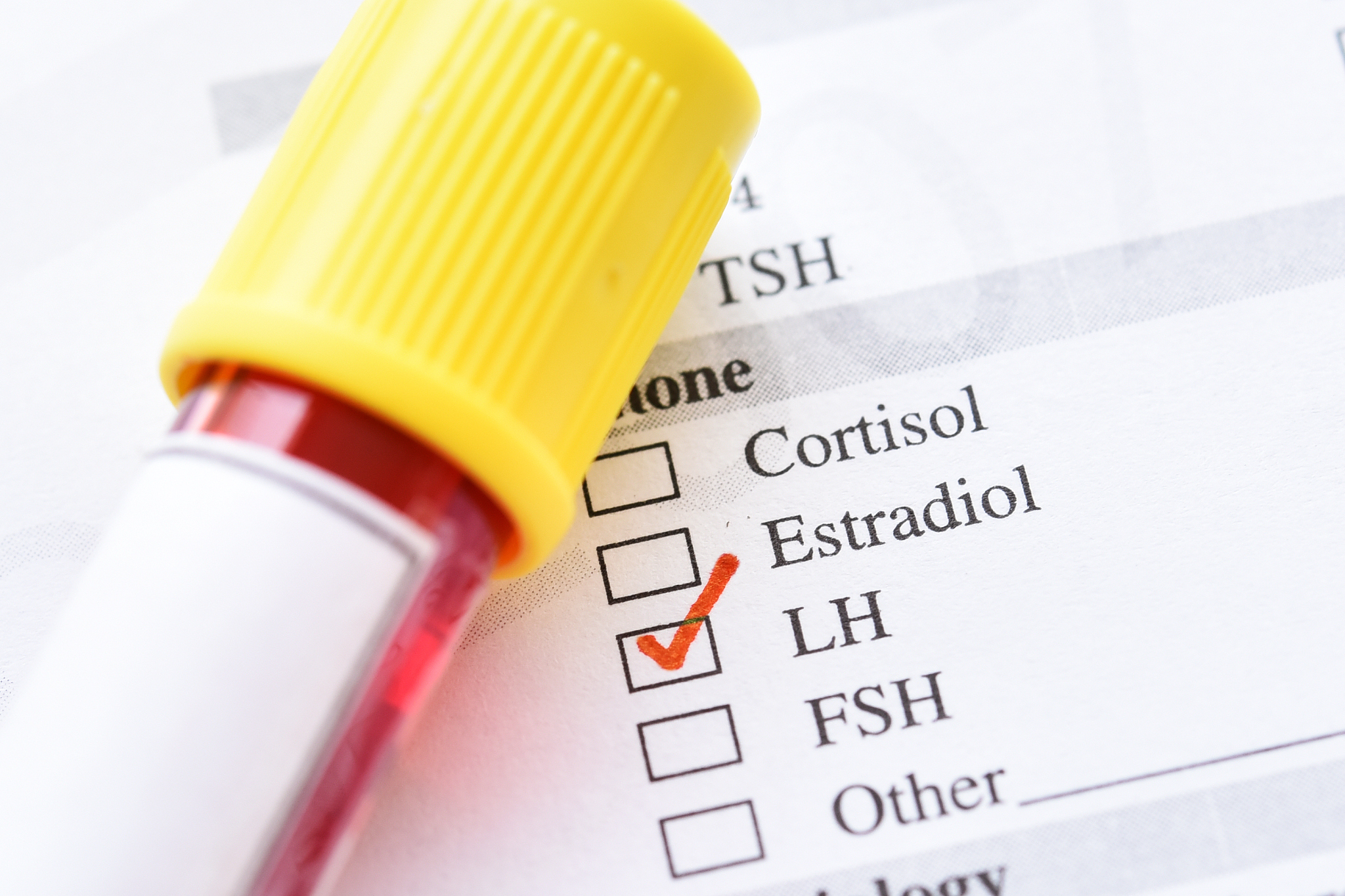 奶牛繁殖性能关键指标：血液中的秘密