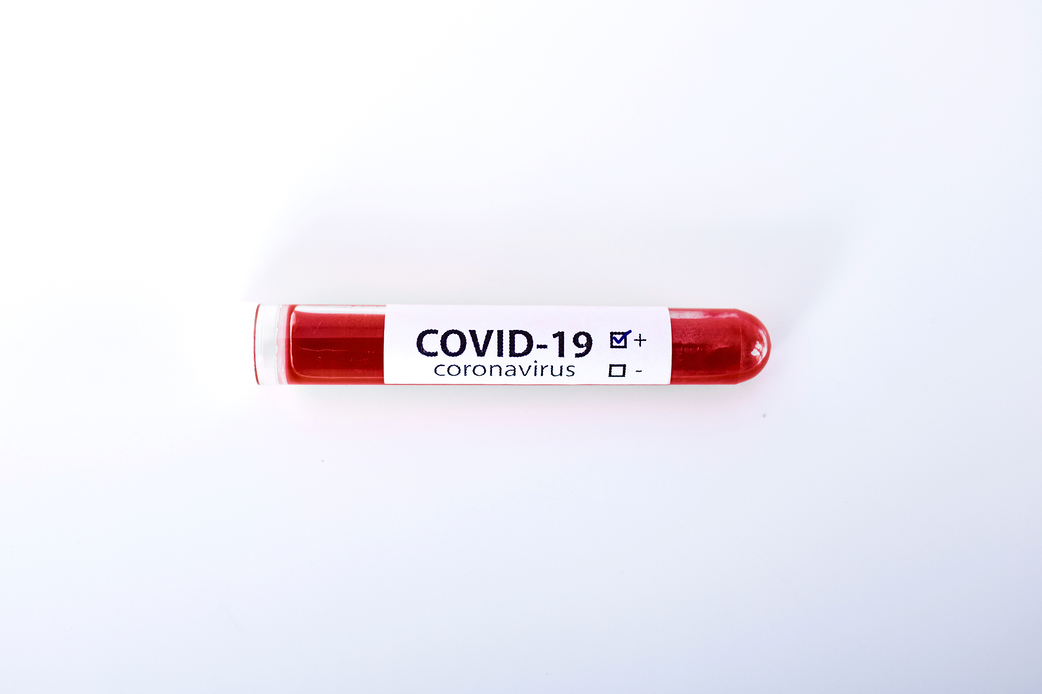 positive covid-19 test and laboratory sample of blood testing fo