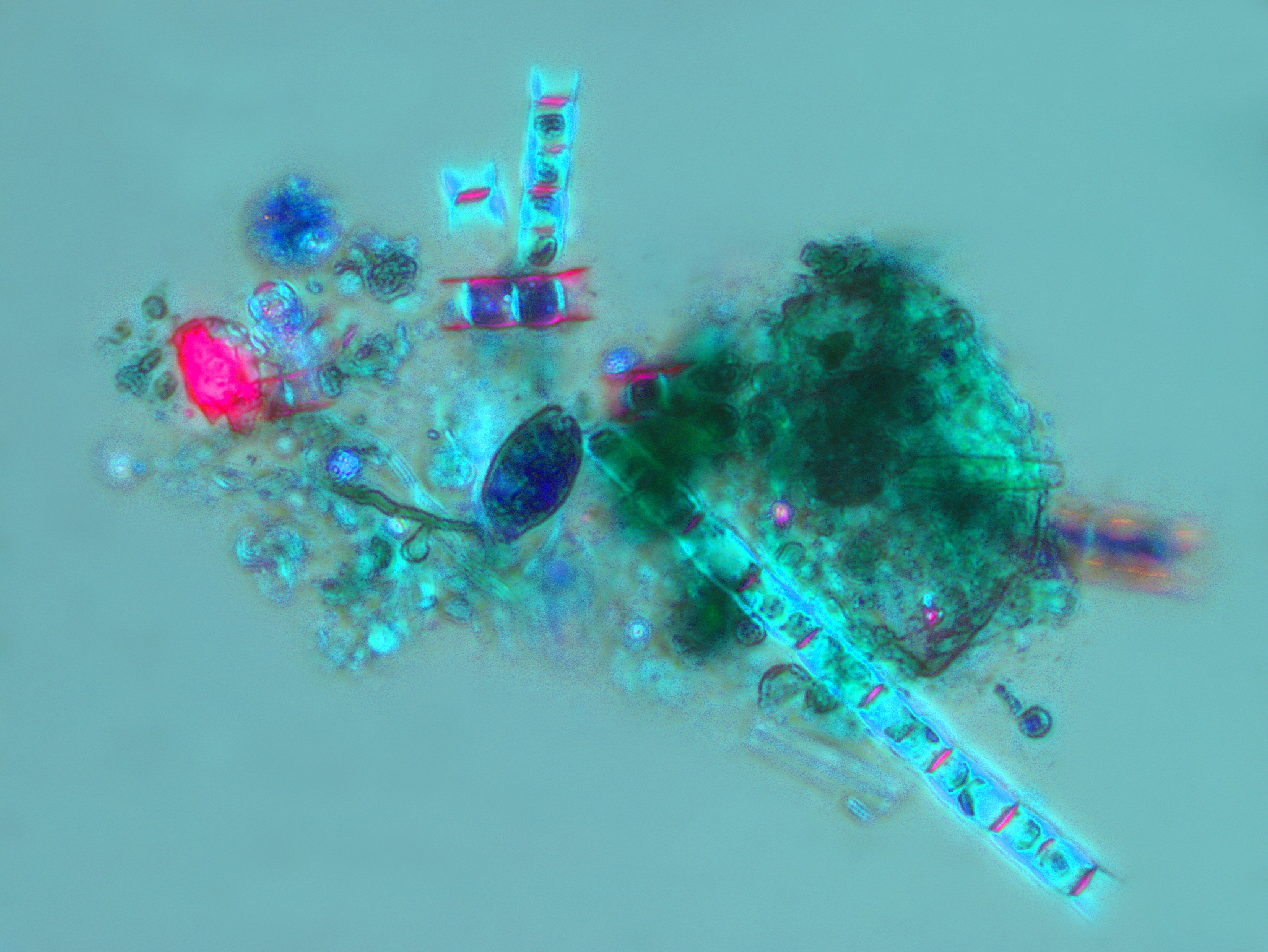 在解决海洋污染问题上运用到了微生物的什么特性