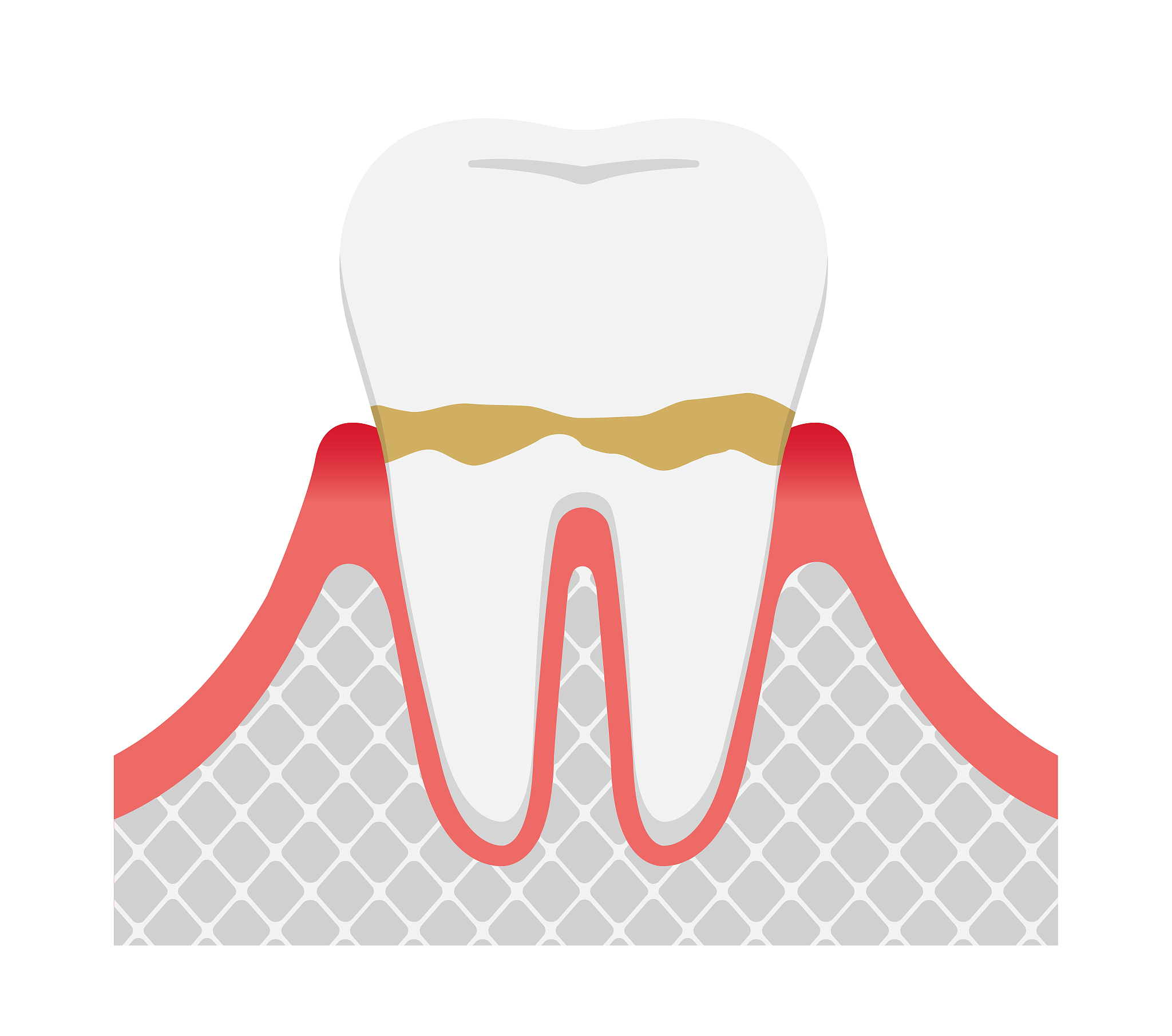 swollen gum pain symptom what is possible disease