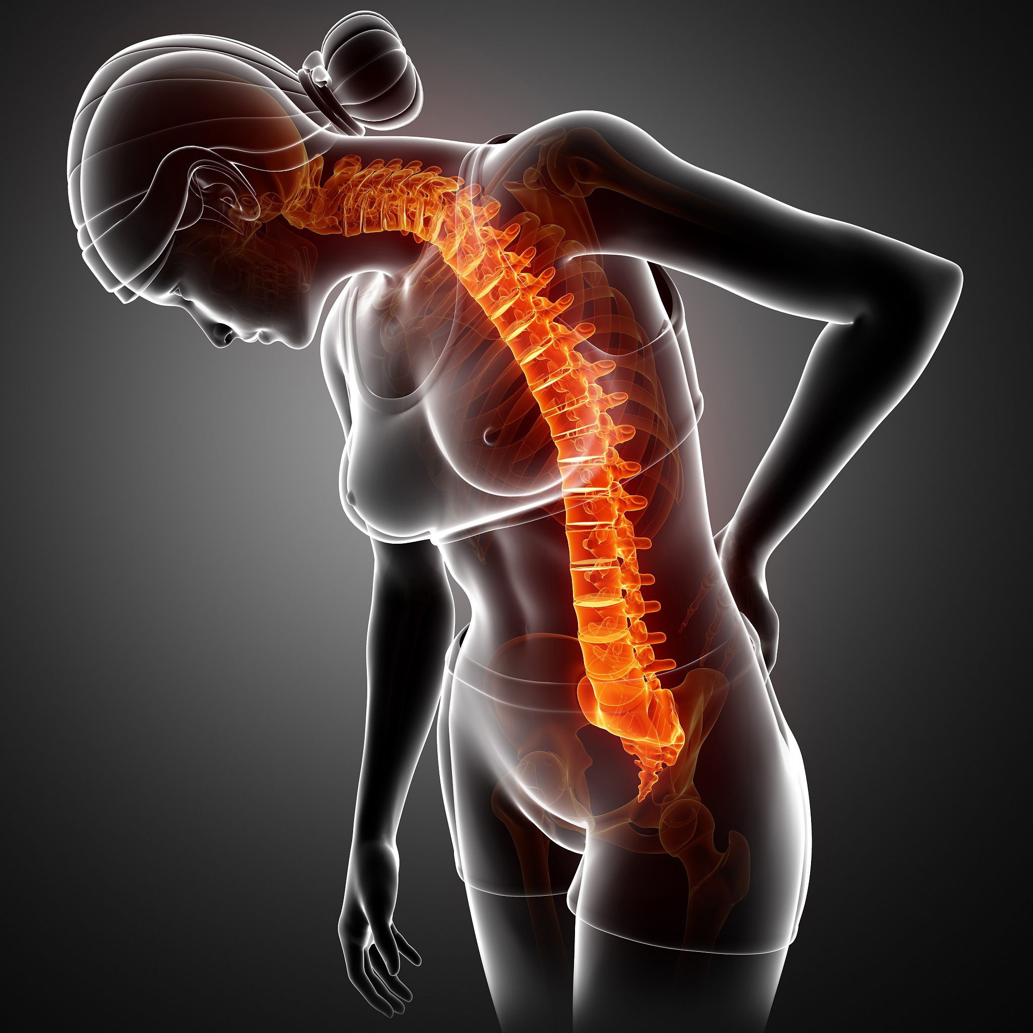 为什么腰椎间盘突出症症状轻就只会腰痛而症状严重就会腰痛腿痛？