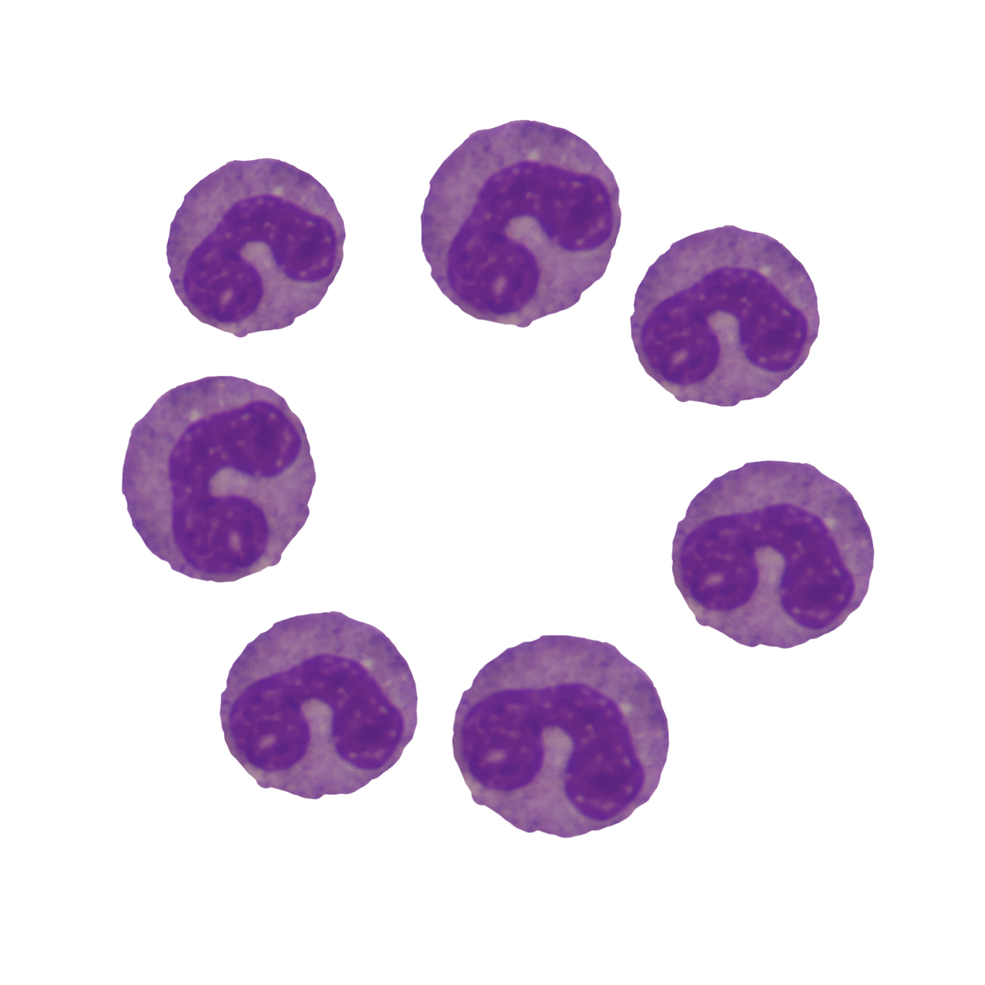 鼎鑫沙棘植物盖片可以治疗贫血吗？