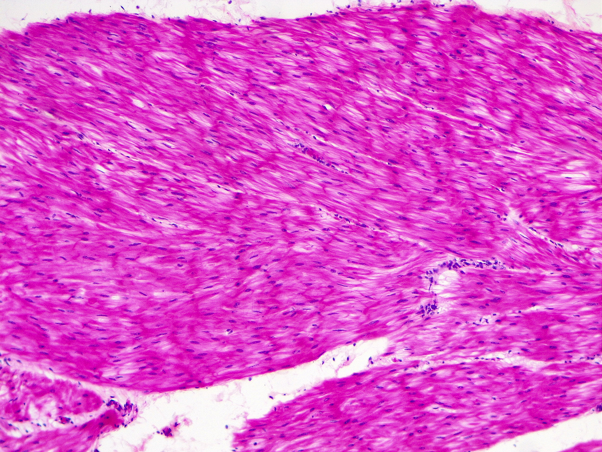 系统解剖学肌学重点：肌肉组织、结构与功能详解