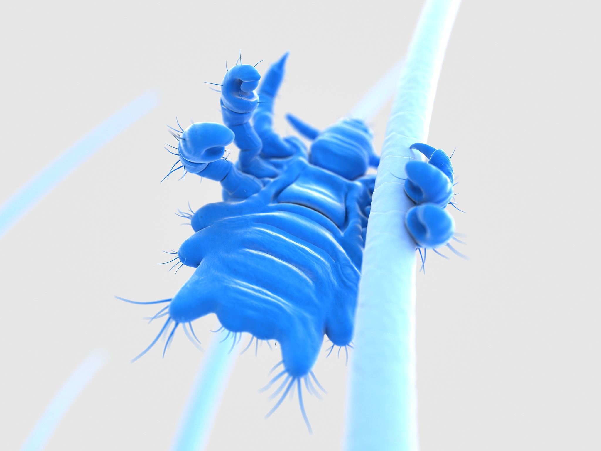 怎么根治阴虱