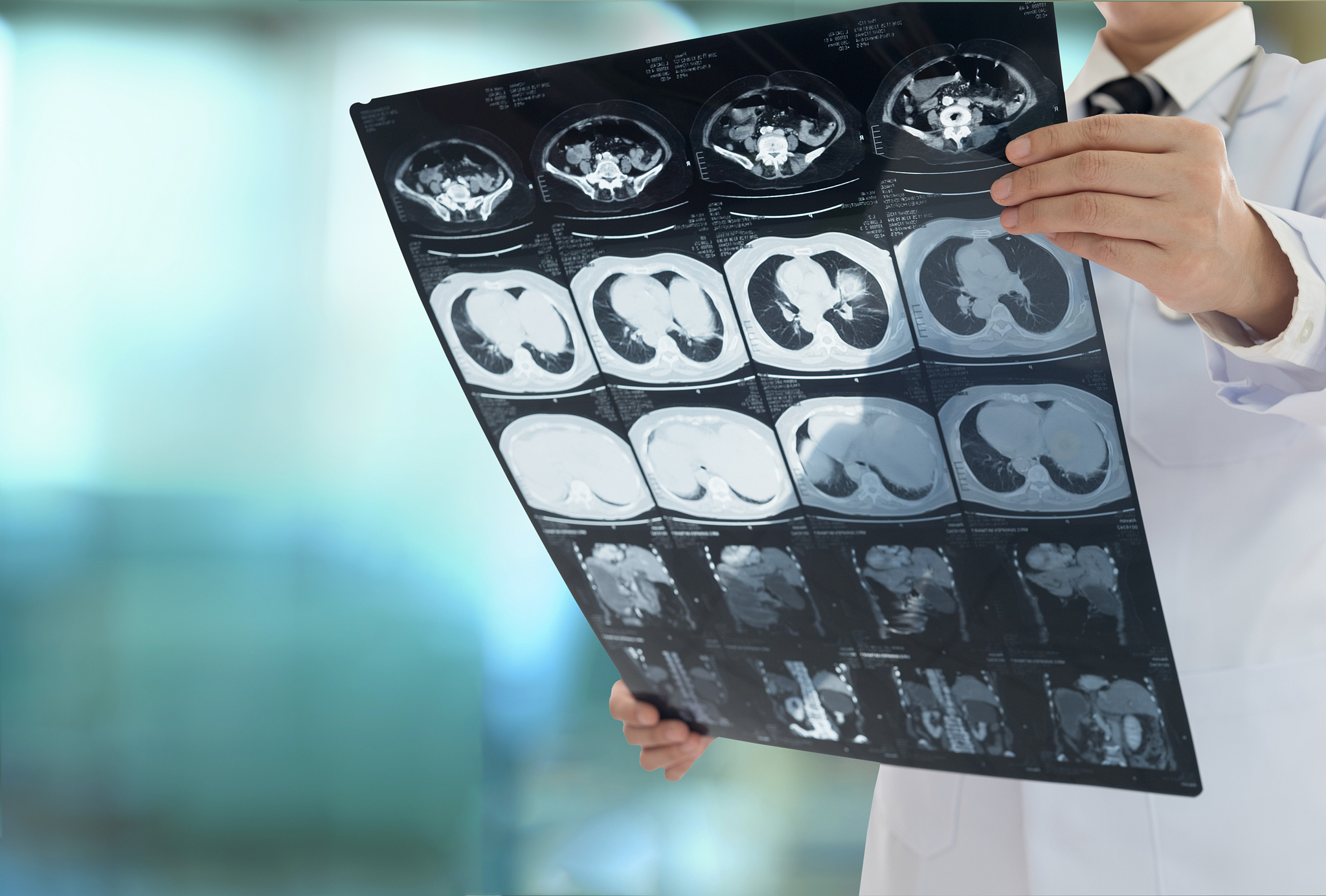 X 射线特征 - 医学成像和诊断中的关键信息