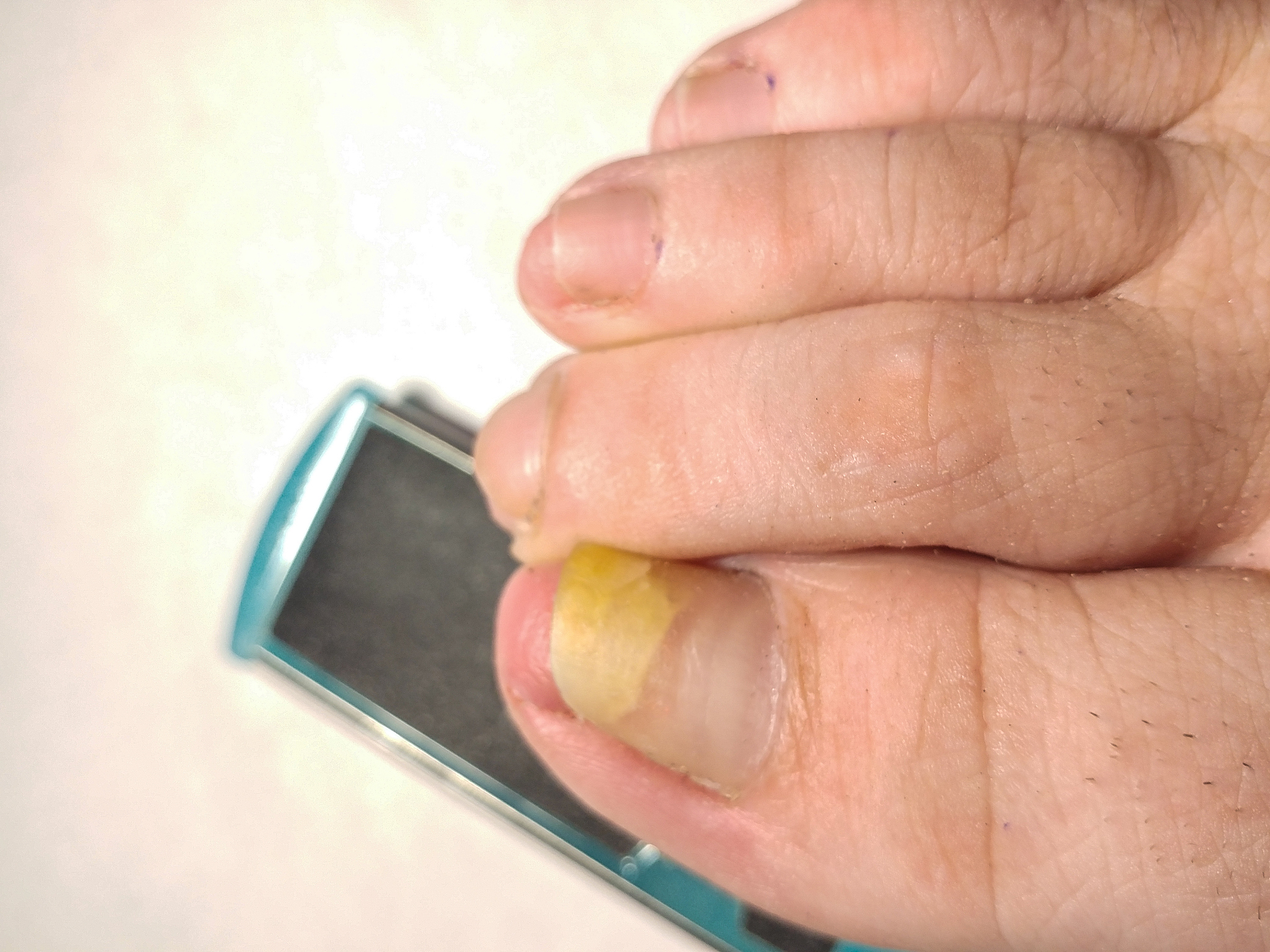 指甲与浓硝酸反应为何溶液不发黄？