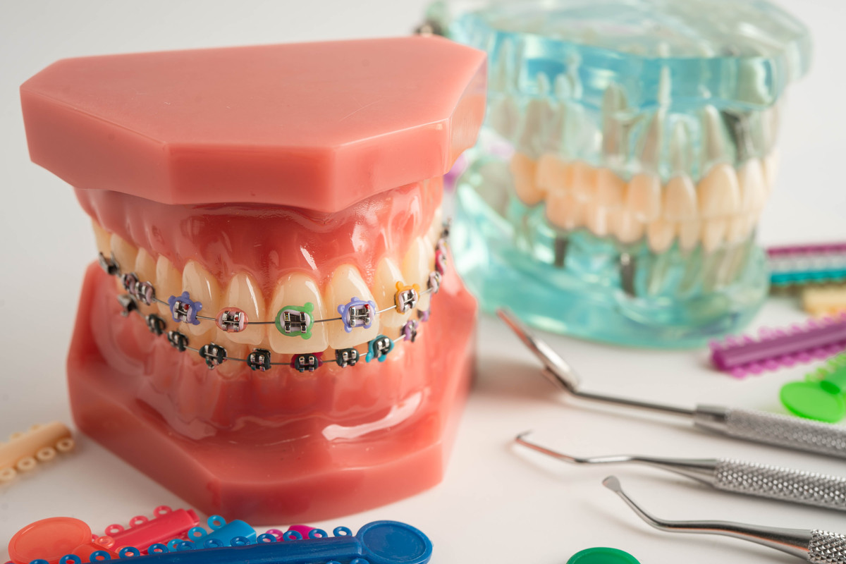 中山做牙齿矫正又好又便宜