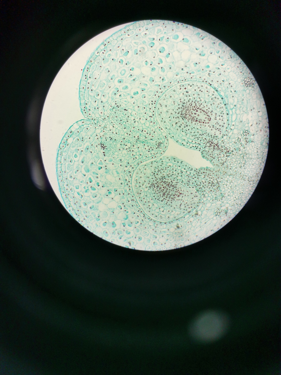 若你在制片中仅看到游离芽孢而很少看到芽孢囊和营养细胞试分析原因。