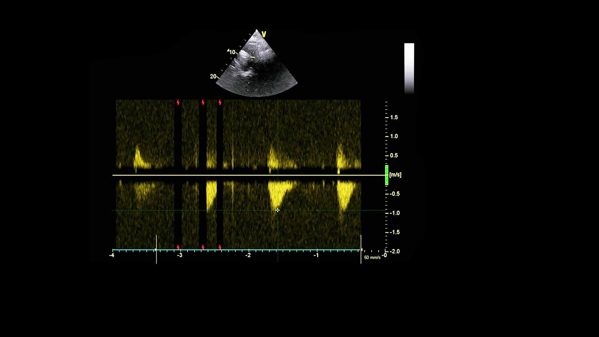 一束带阻滤波器的光和一束全通滤波器的光互相干涉输出光是什么