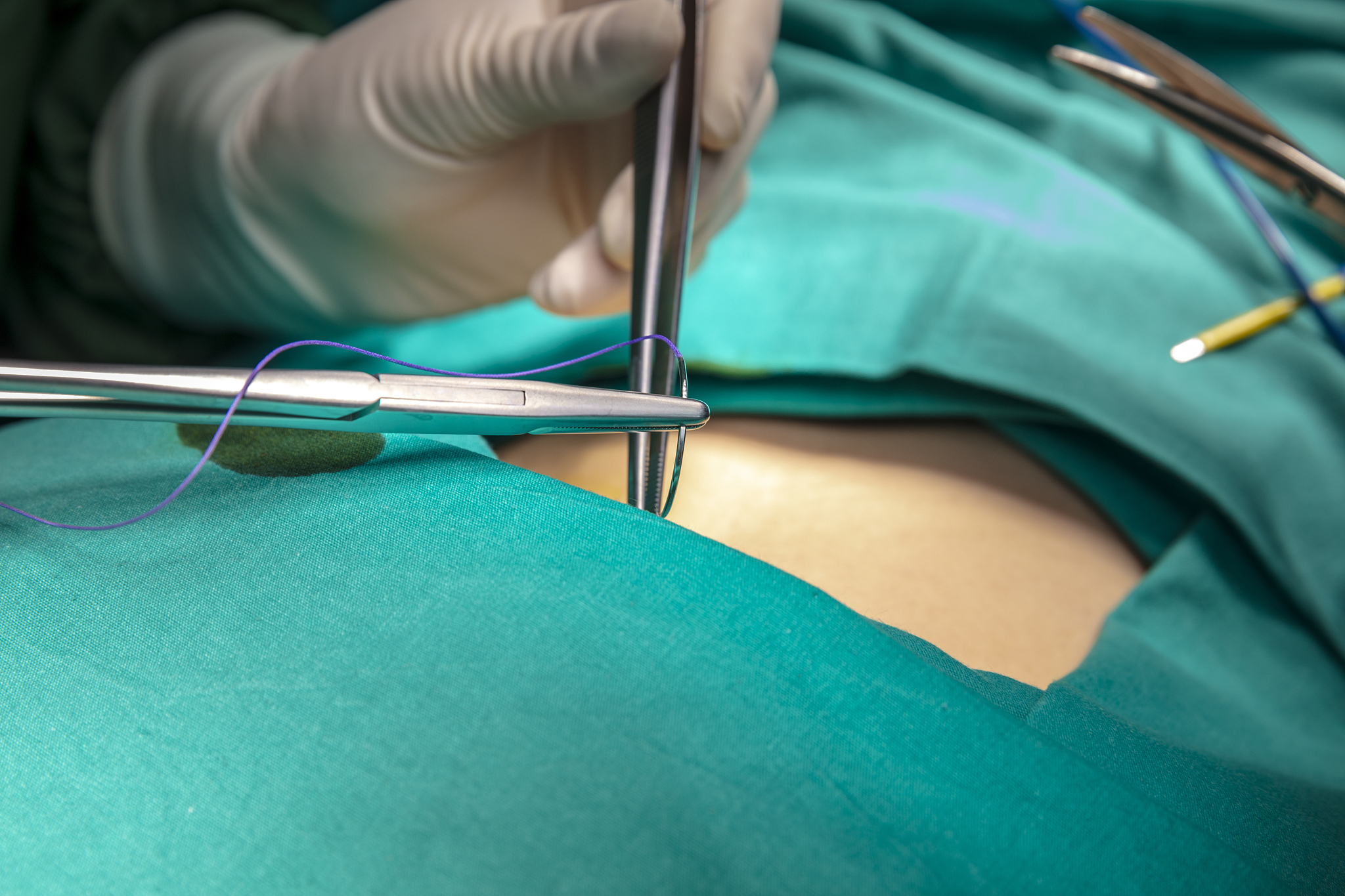 doctor make a surgical stitch